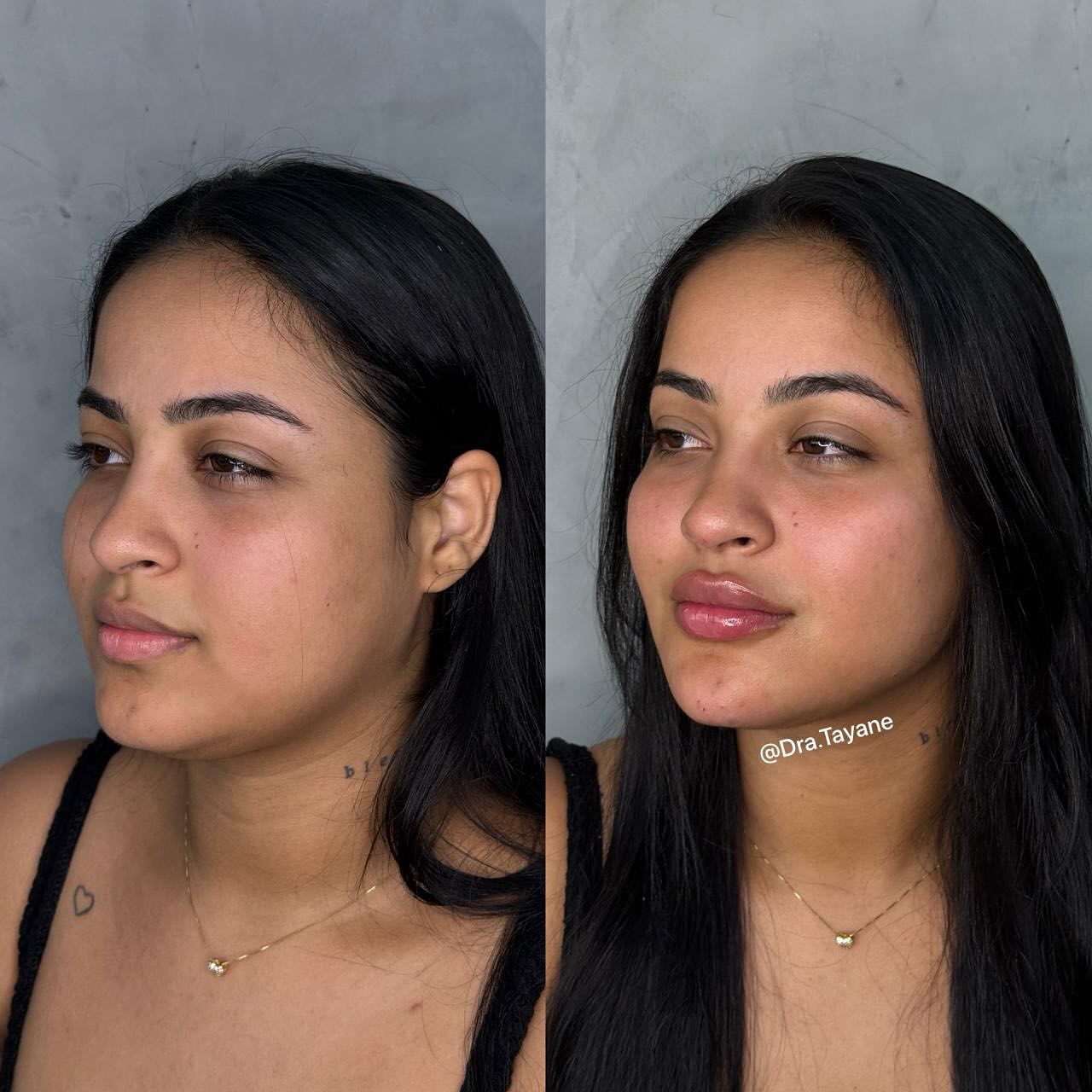 dra.tayane Facebook ad: Natural, leve e do jeitinho que ela sonhou