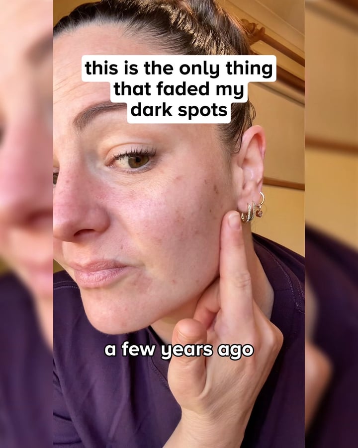 Hey Bud Facebook ad: Finally Found What Fades My Dark Spots