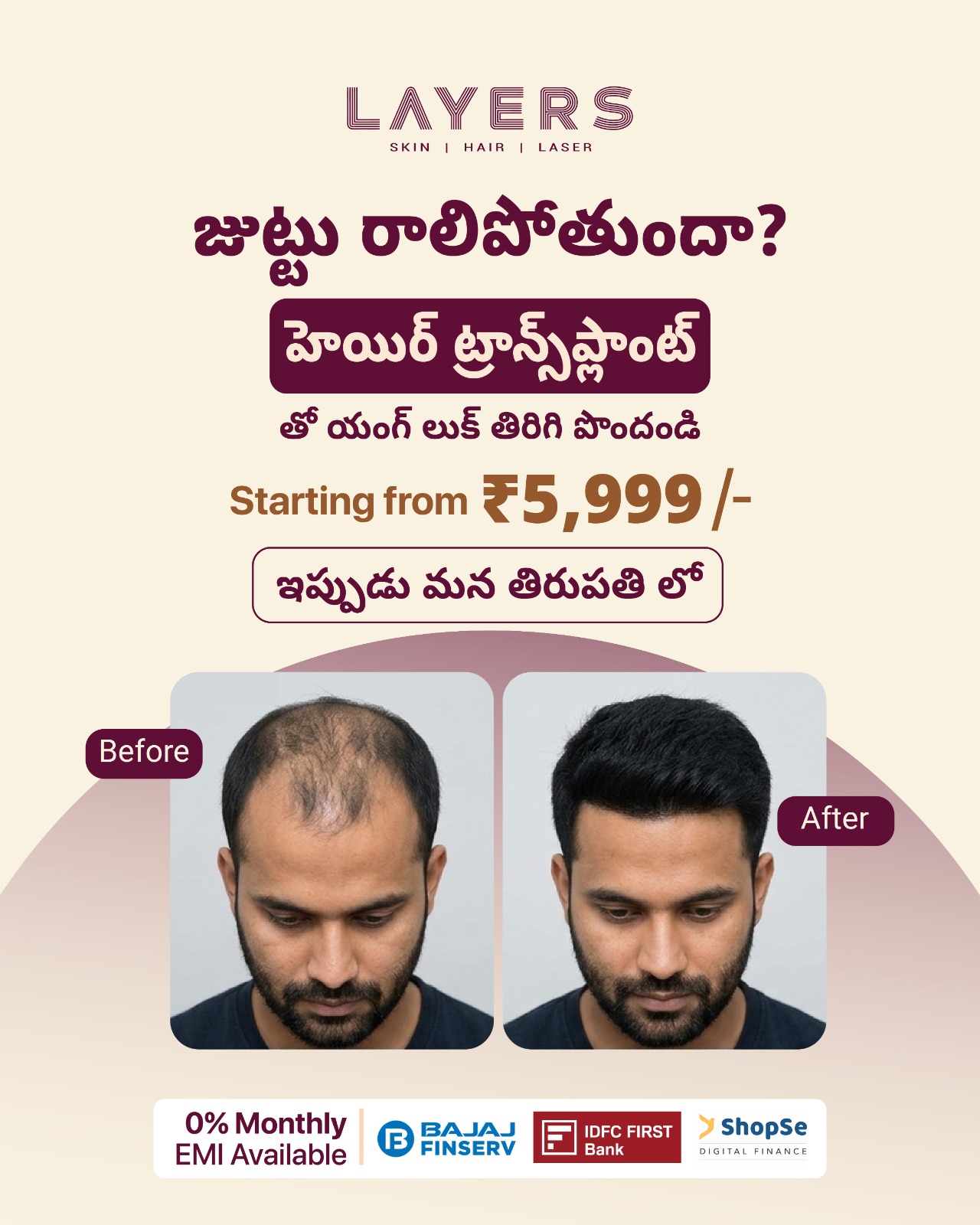 Layers Clinics - Skin & Hair Facebook ad