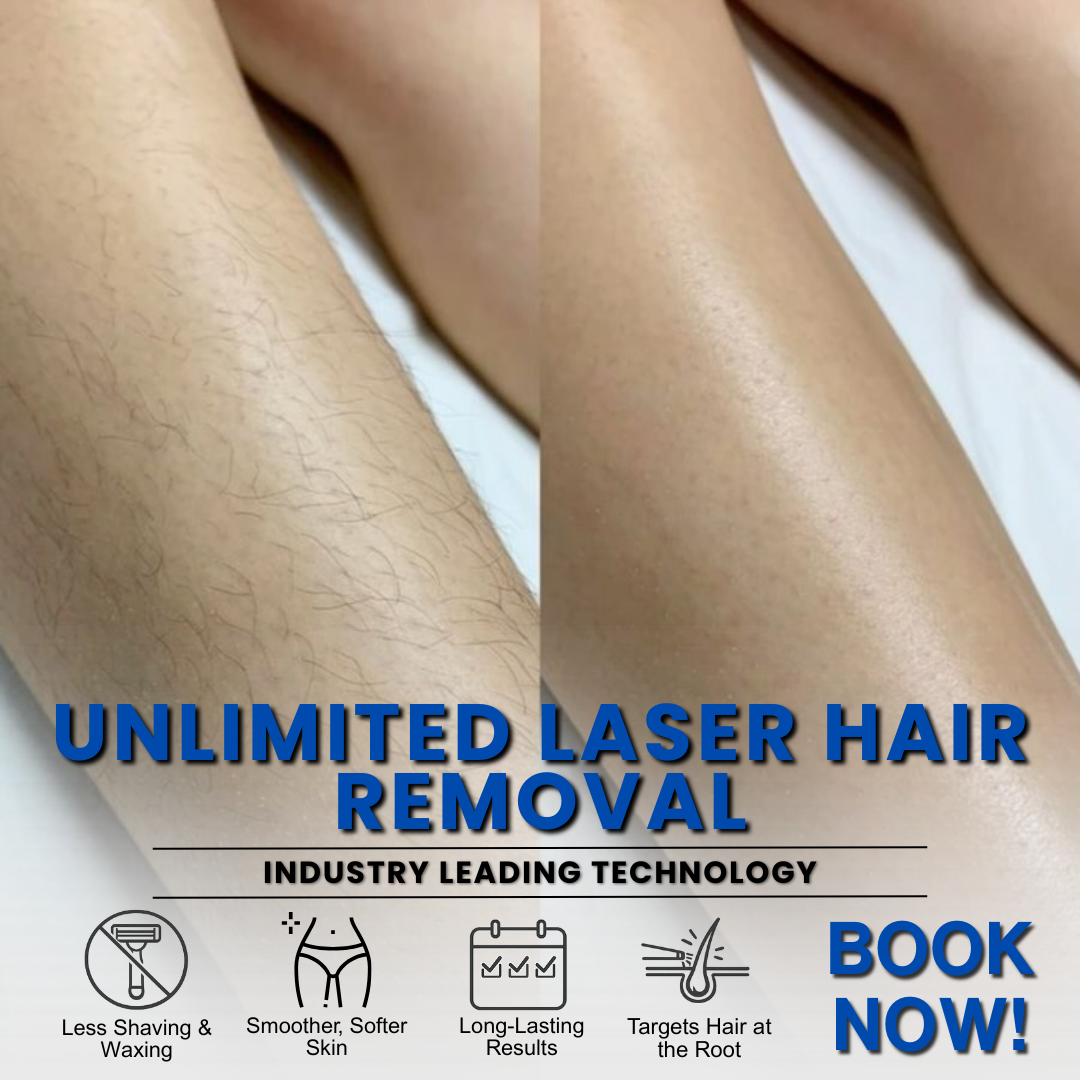 Beauty Matched Med Spa Facebook ad: Flawless Skin, Zero Hassle