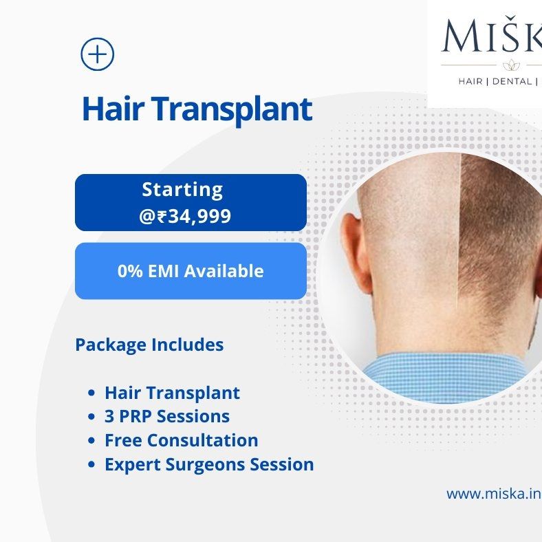 Miska Facebook ad