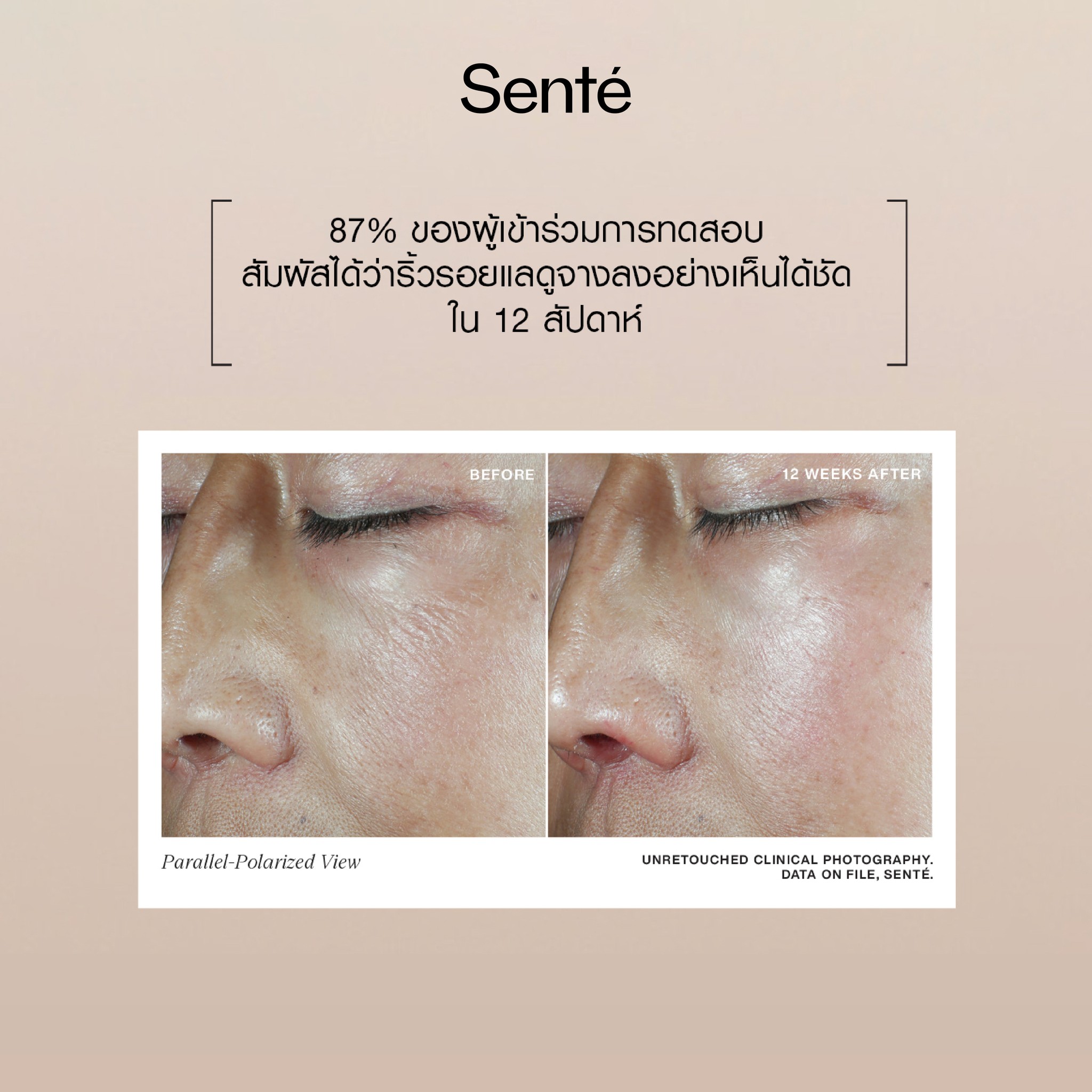 Sente Thailand Facebook ad: ผลิตภัณฑ์ Medical Grade Skincare จากอเมริกา