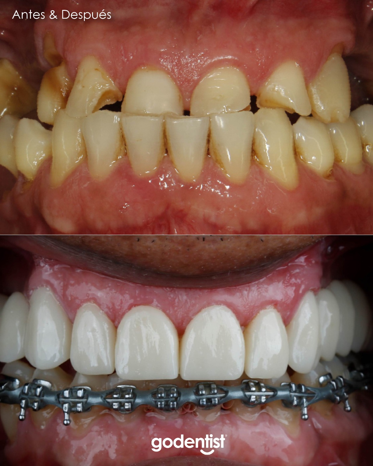Clínicas Odontológicas Go Dentist Facebook ad: Valoración GRATIS