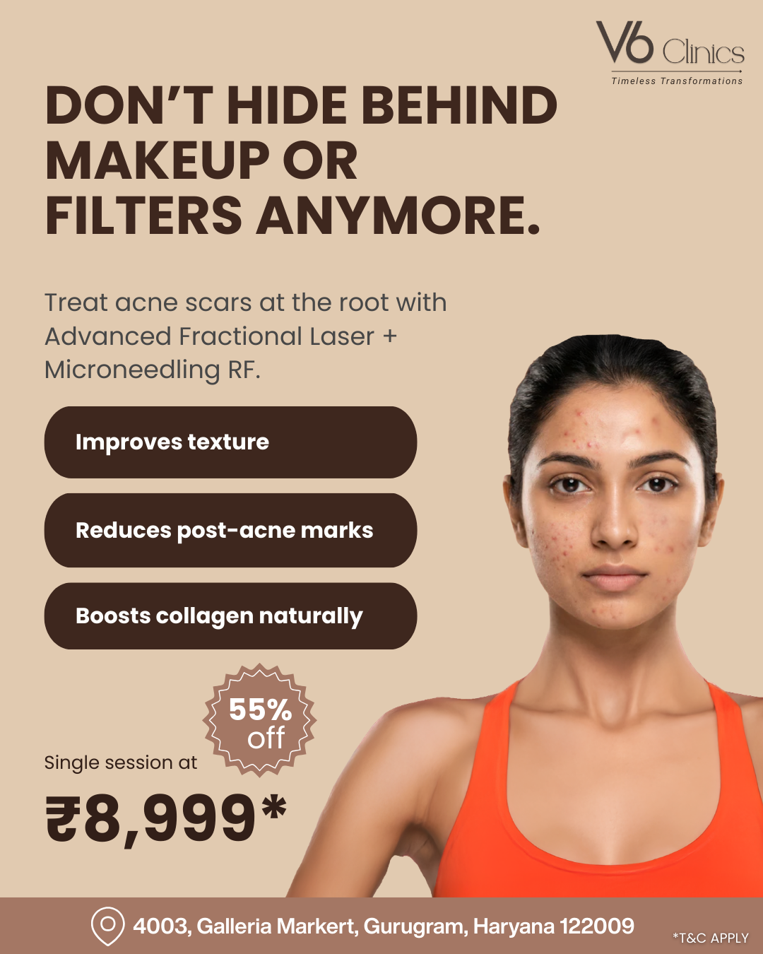 V6 Clinics Facebook ad: Say Goodbye to Acne Scars @ ₹8,999