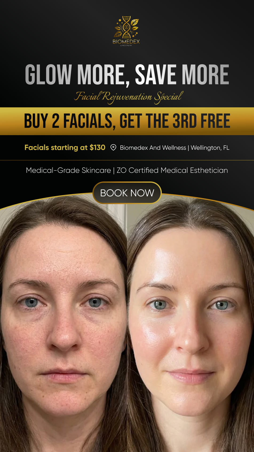 Biomedex And Wellness Facebook ad: Glow more, save more