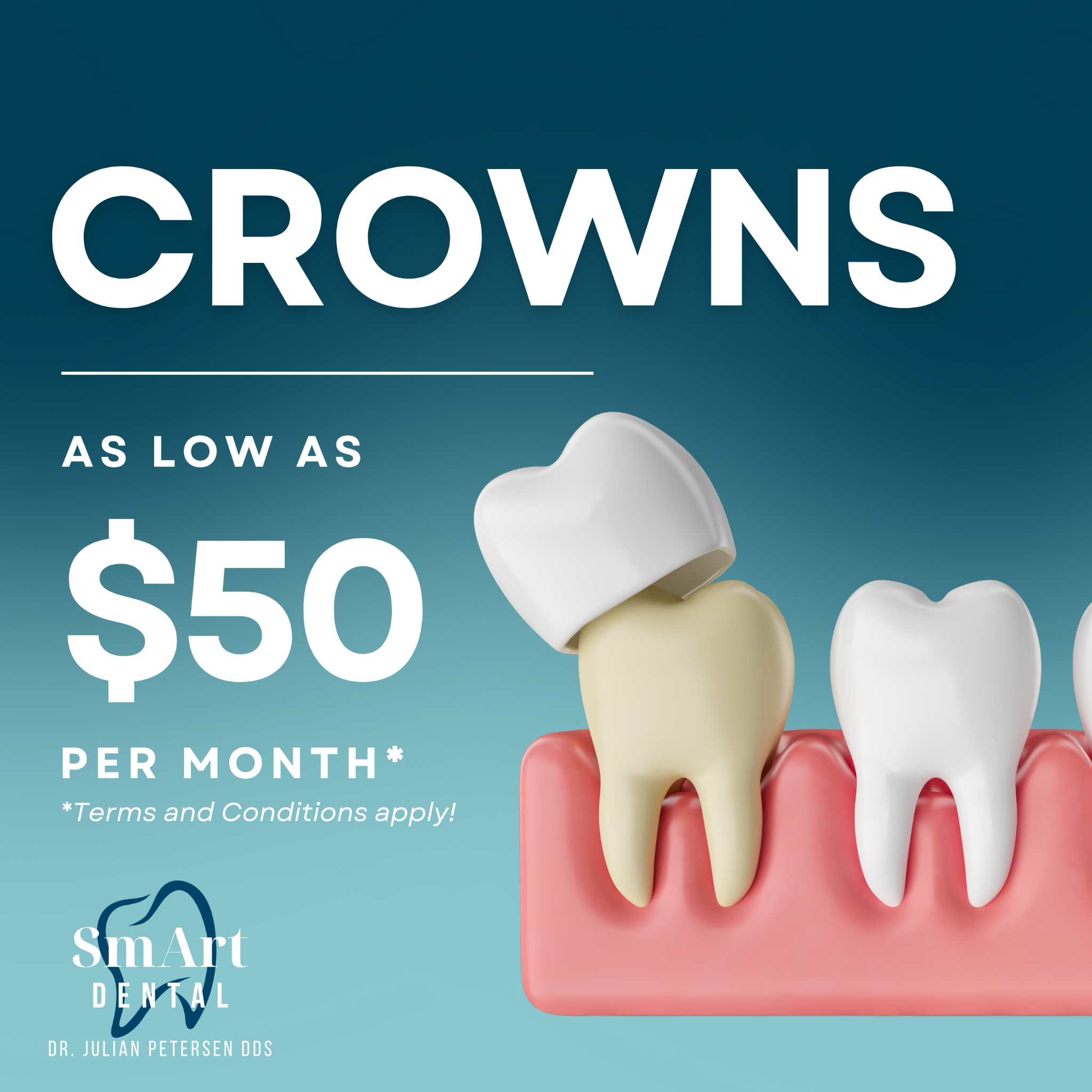 Smart Dental Richland Facebook ad: Dental Crowns starting at $50/month!