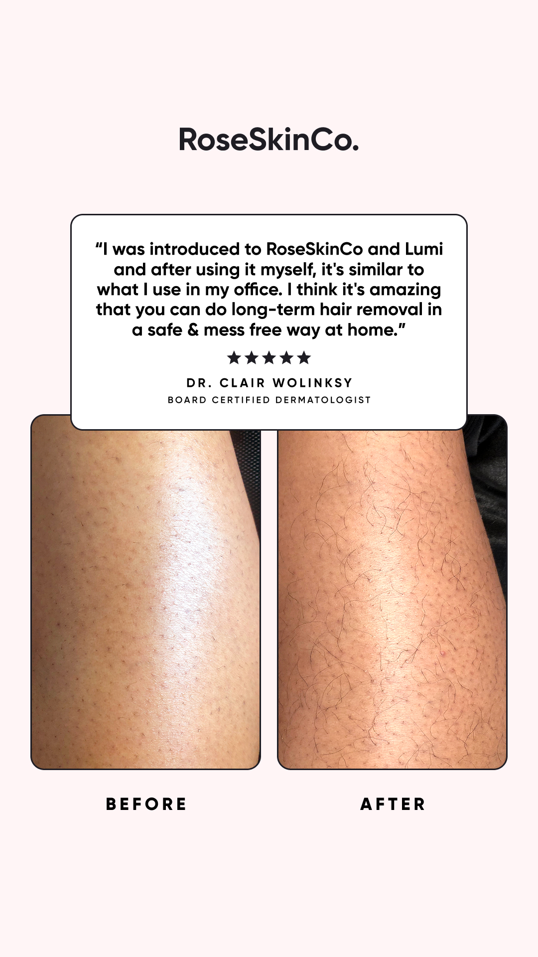 Rose Skin Co Facebook ad