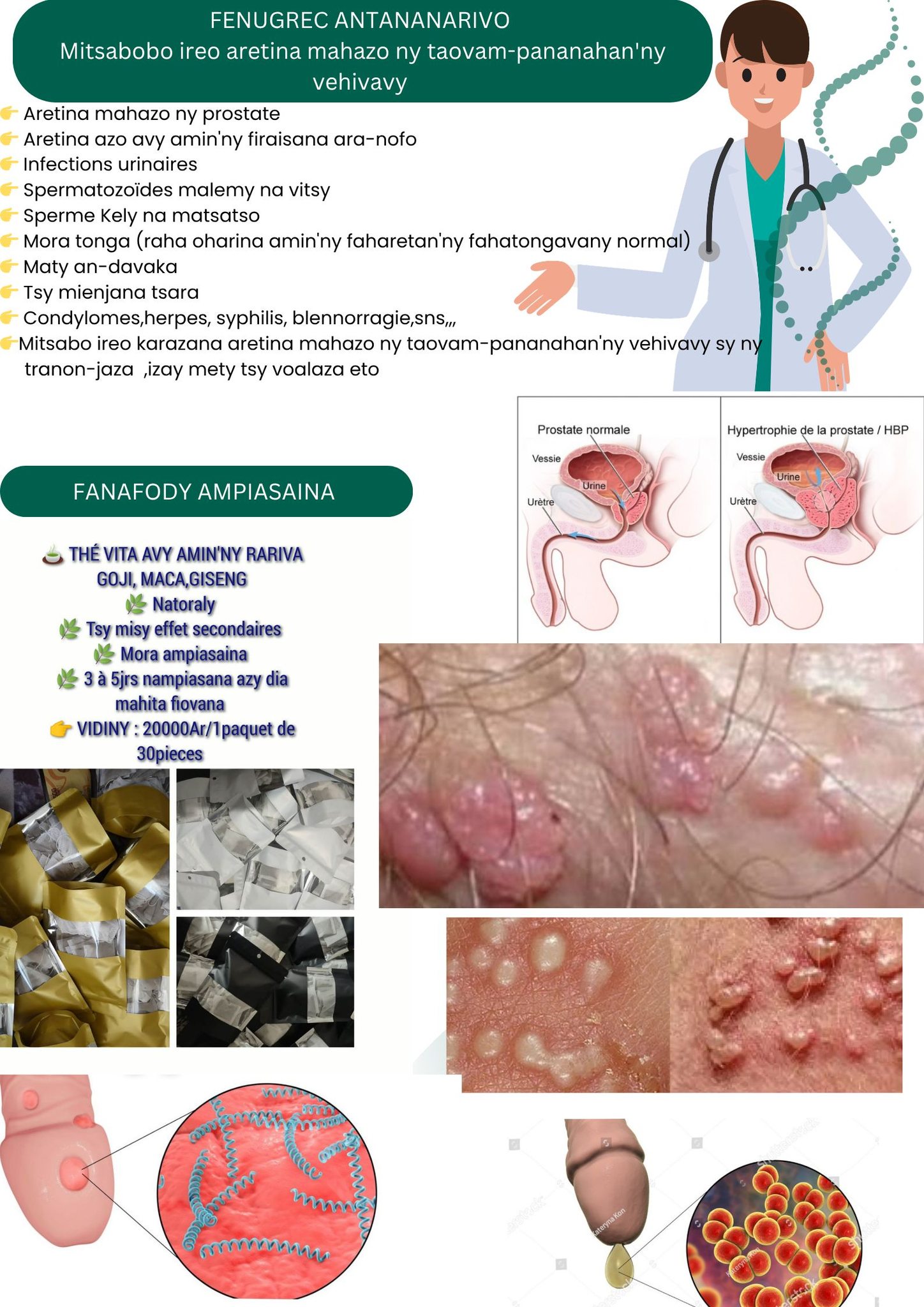 Fenugrec Antananarivo Facebook ad: IREO SORITR'ARETIN'NY PROSTATY
