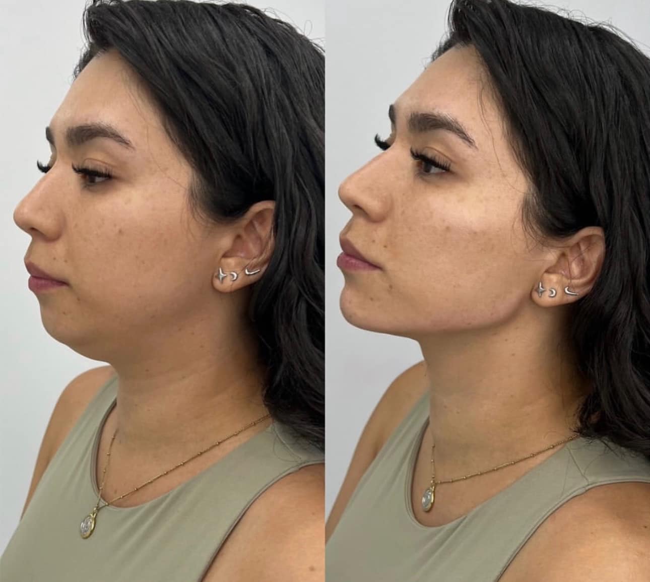Clinica spa arte cuerpo  Facebook ad