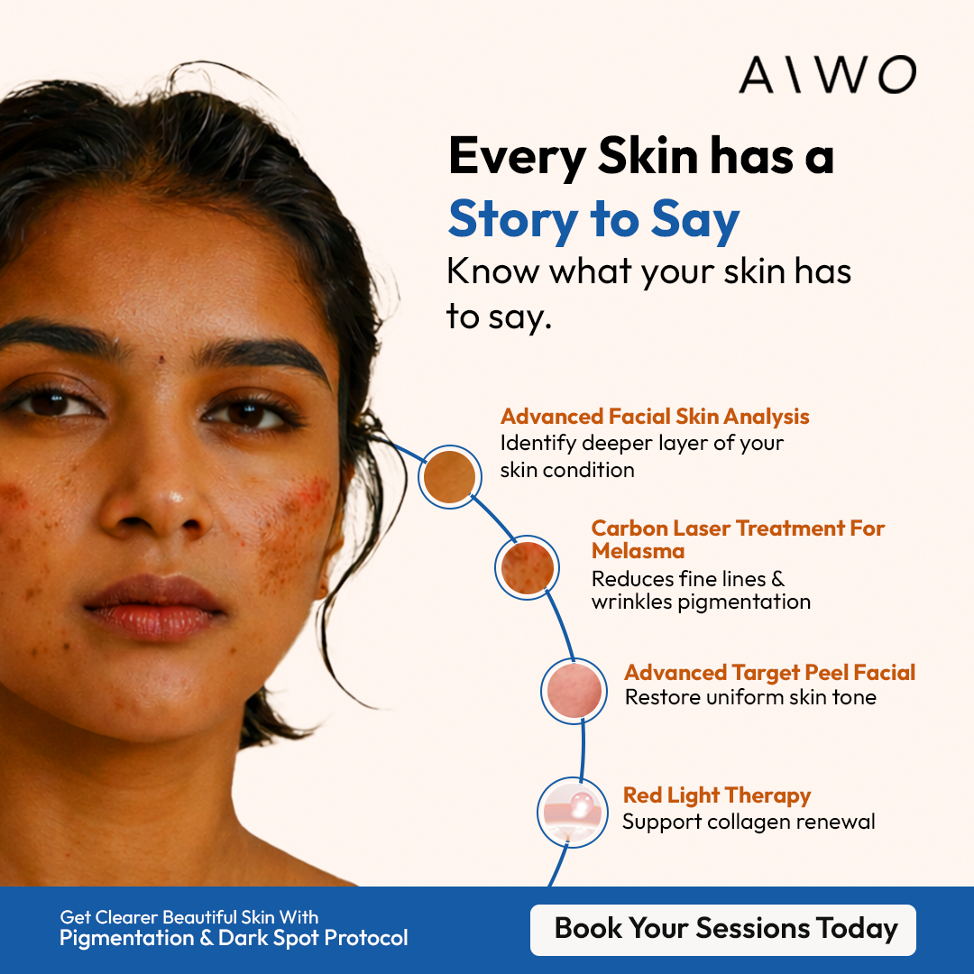Aiwo Facebook ad