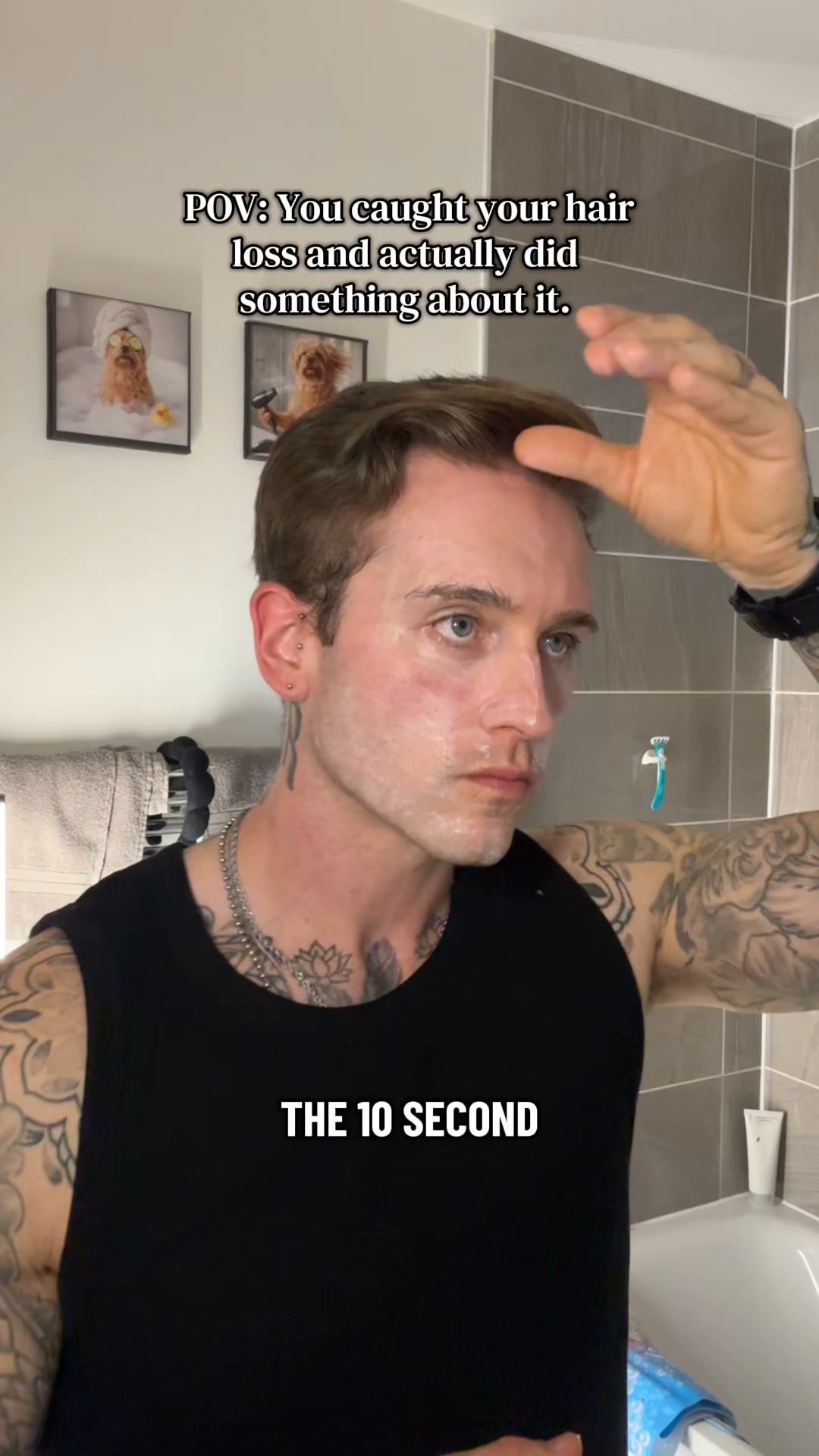 Sons Facebook ad: Your hairline. Your call.