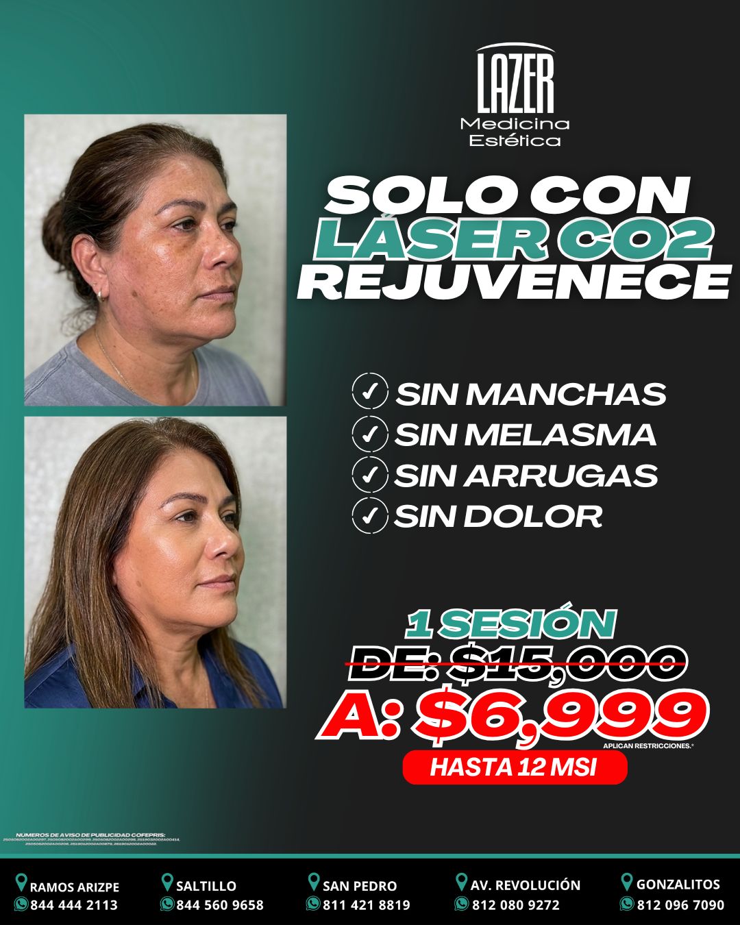 Lazer Medicina Estética MX Facebook ad: ¡Aprovecha nuestra promoción!
