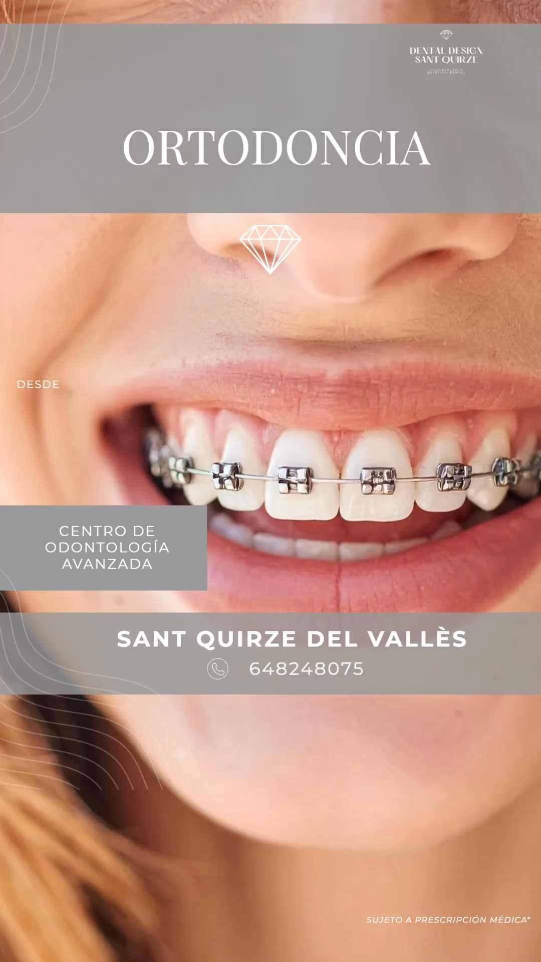 Dental Design Sant Quirze Facebook ad: Ortodoncia invisible y convencional