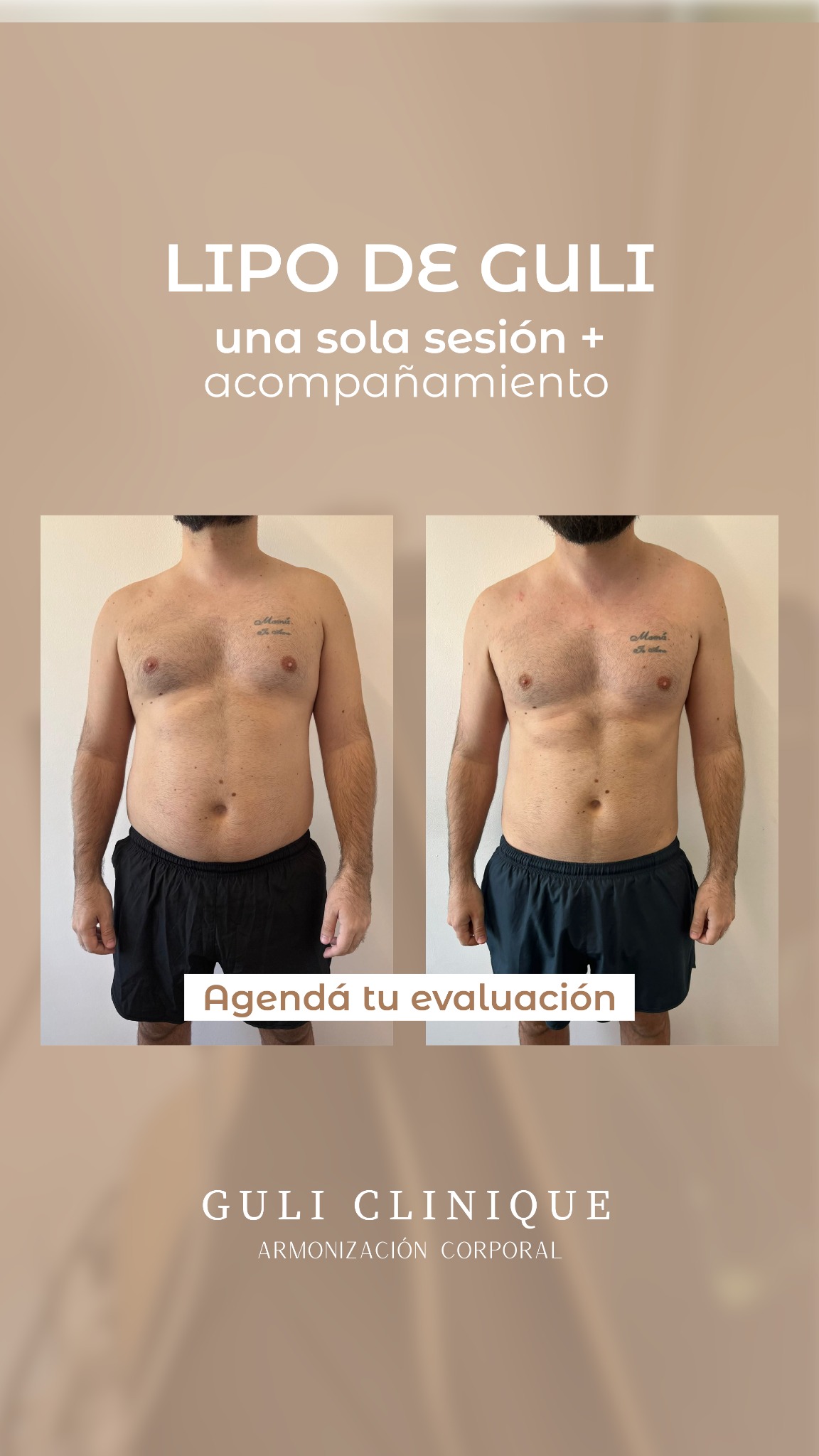 Guli Clinique UY Facebook ad: Chatea con nosotros