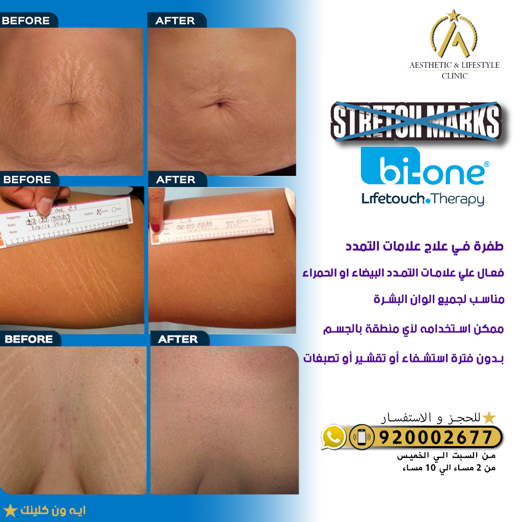 A1 Clinics Jeddah Facebook ad: حصريا في جهاز بي-ون هو طفرة في علاج…