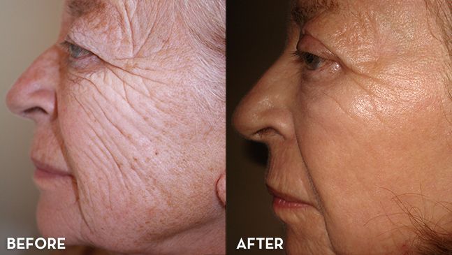 Advanced Skincare & Aesthetics Facebook ad