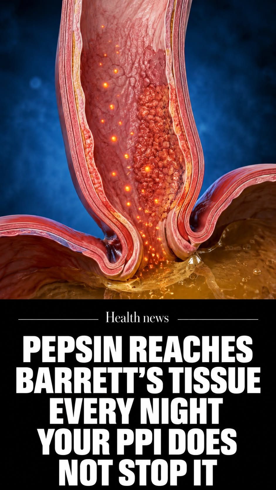 Donna Reed Facebook ad: Barrett's Progressing Despite PPIs? Read This.