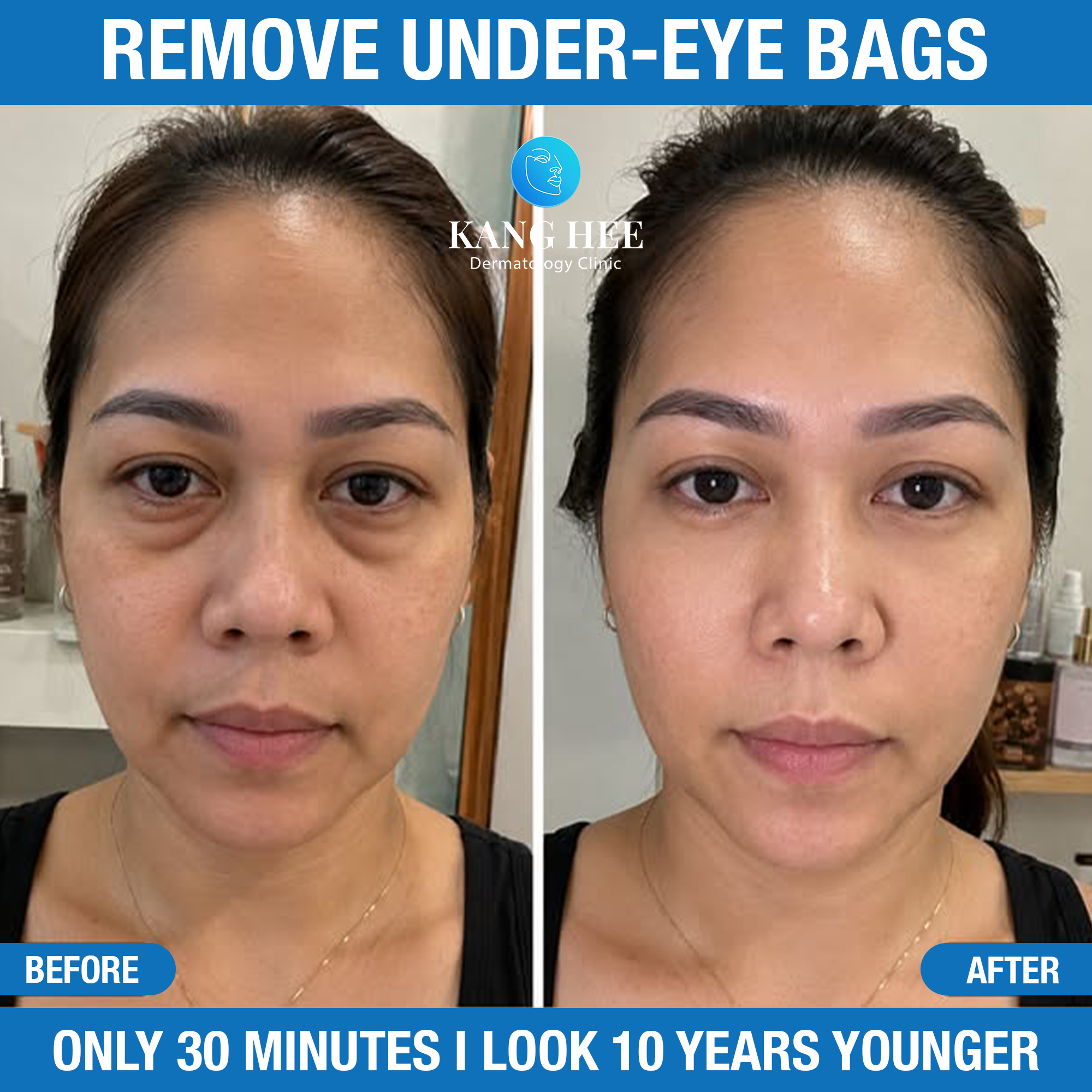 Kang Hee Clinic - Enhancing Your Beauty Facebook ad: 10 years younger just 30 minutes