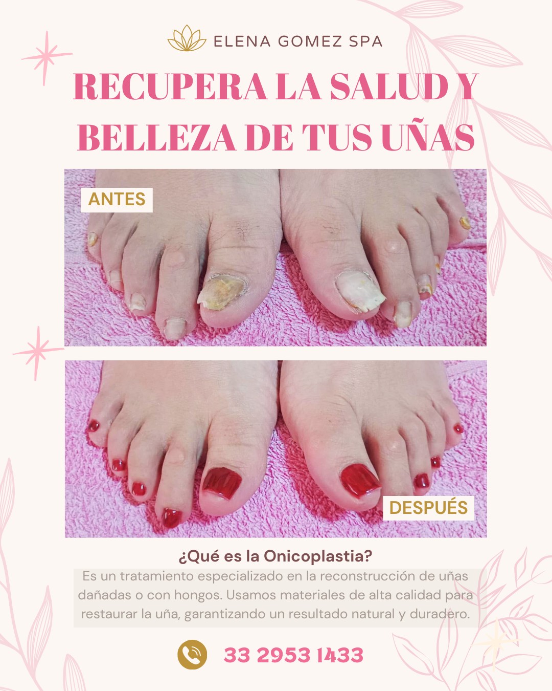 Elena Gomez Facebook ad: Recupera la salud y la belleza de tus…