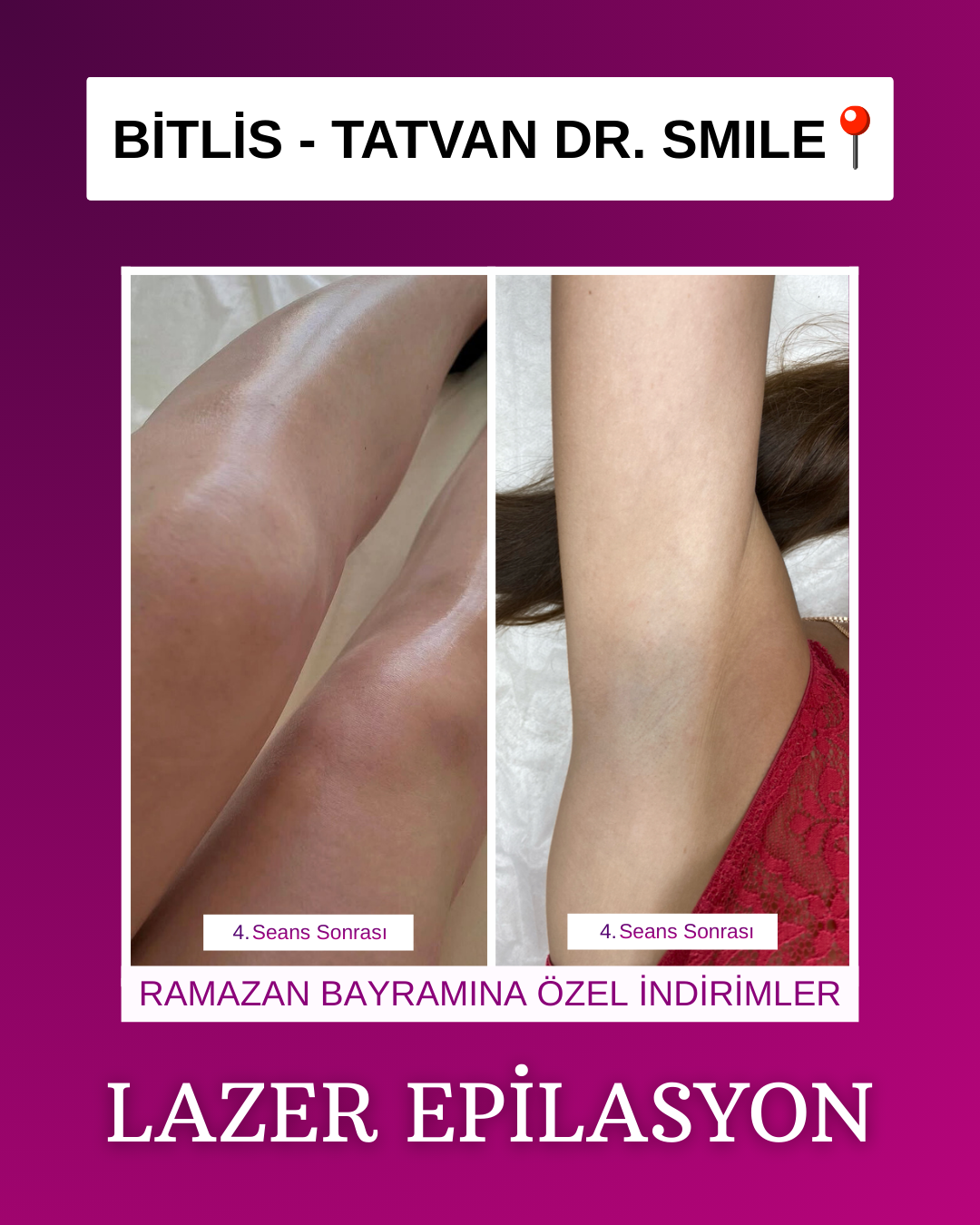 Drsmile.tatvan Facebook ad from Mar 12, 2026