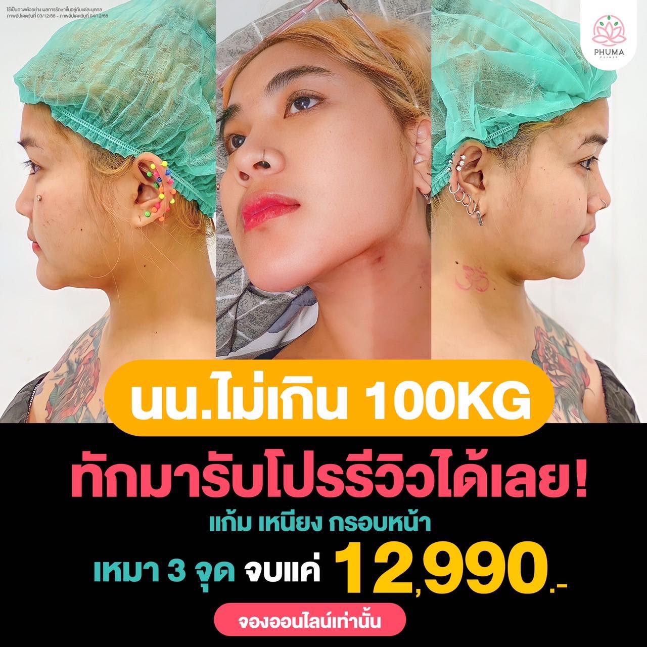 Phuma ภูม่าคลินิก ดูดไขมัน เติมไขมัน Facebook ad