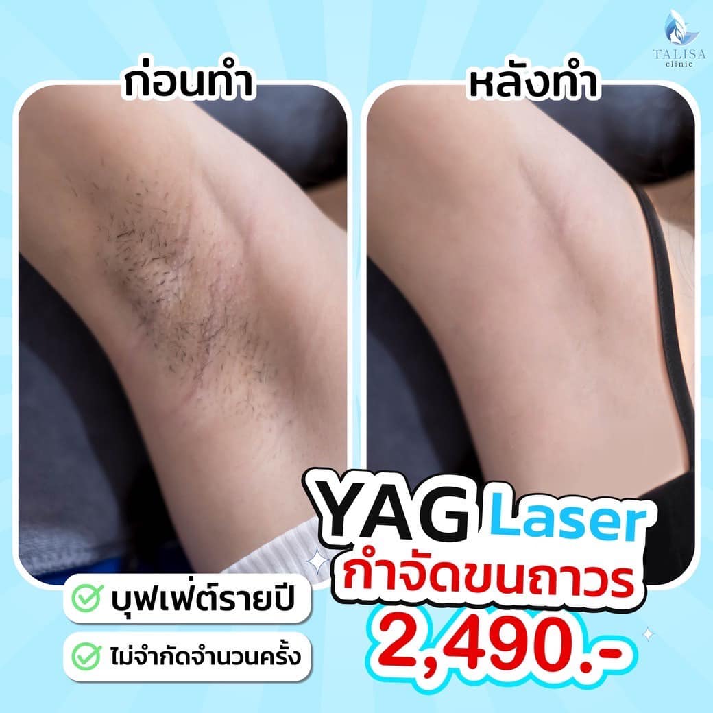 TALISA Clinic Facebook ad
