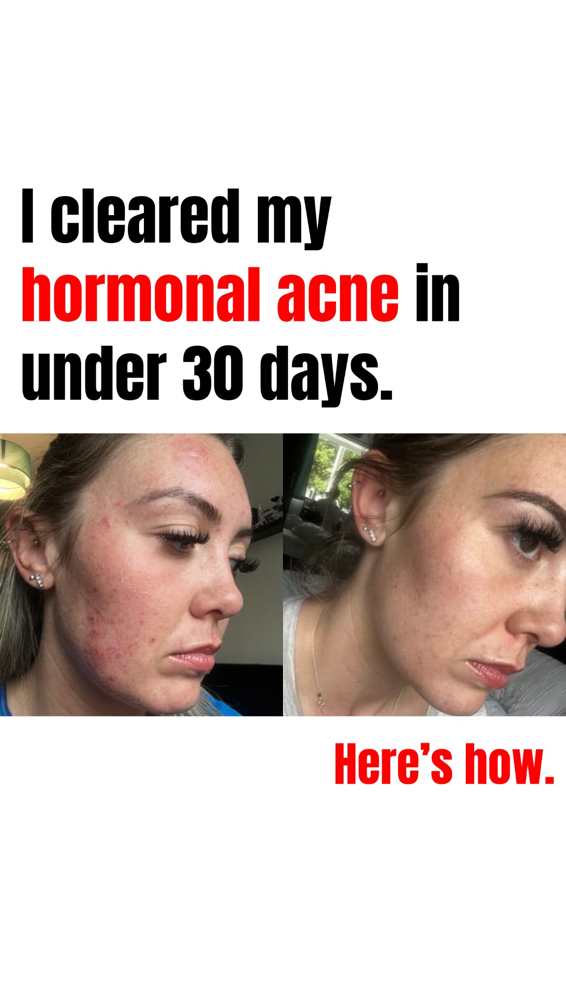 Anne's Skincare Blog Facebook ad