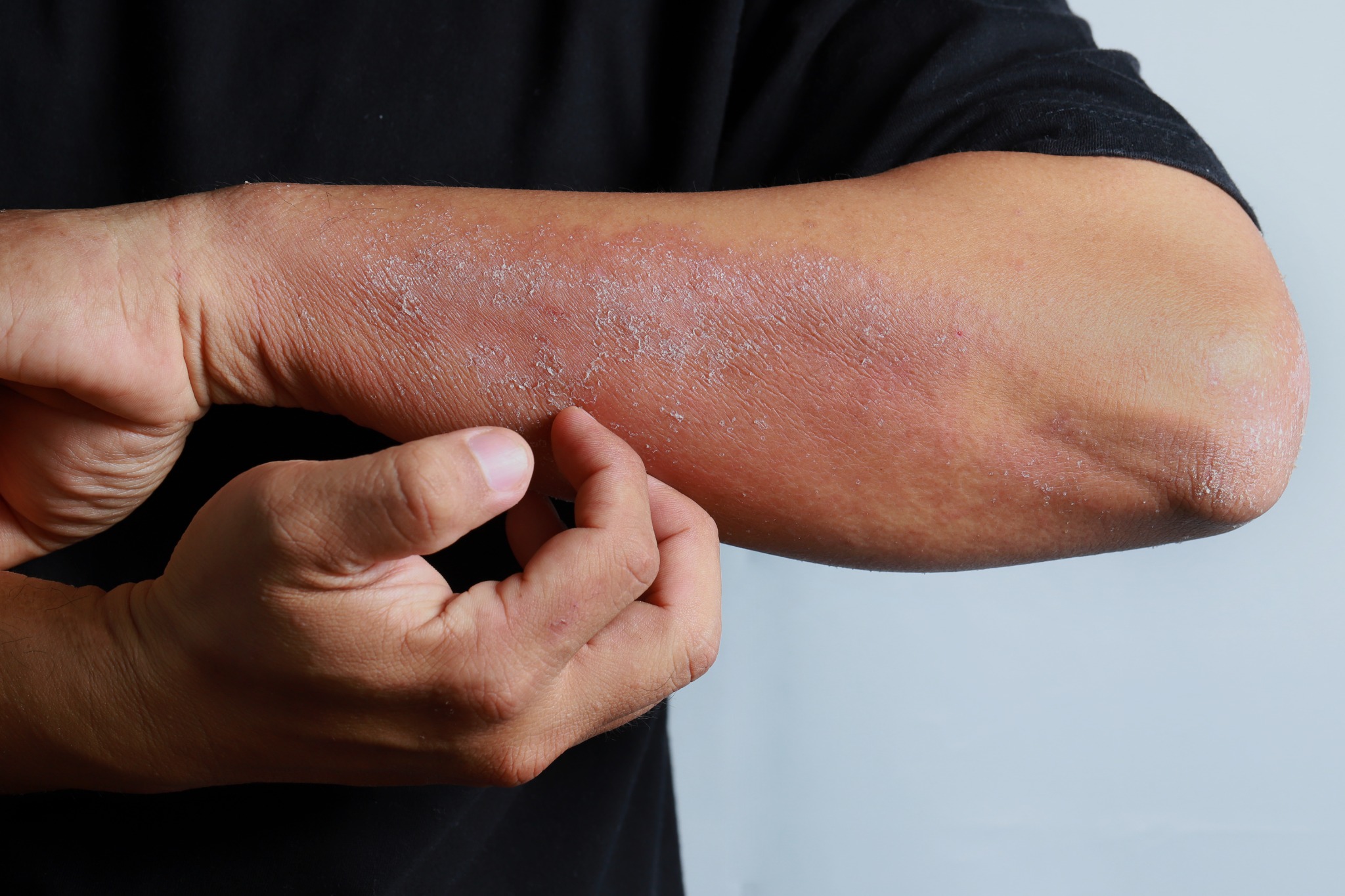 Nature Partnerships Facebook ad: Clinical Presentation Tells Only Part of the Story in…