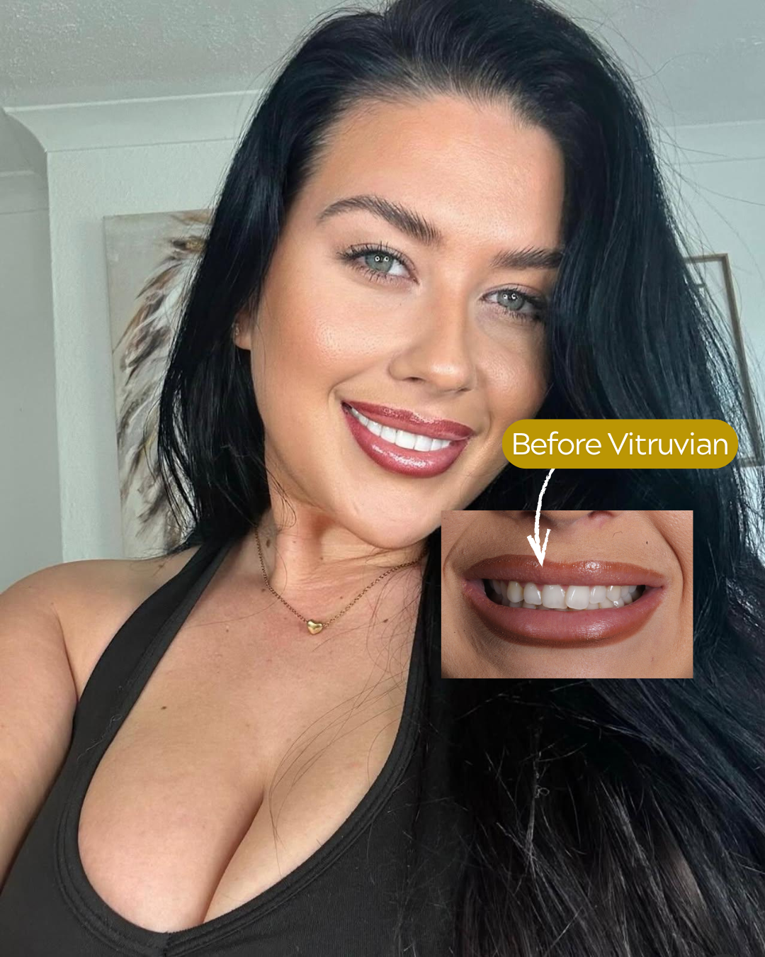 Vitruvian Cosmetic Dentistry and Implant Studio Facebook ad from Jul 2, 2026