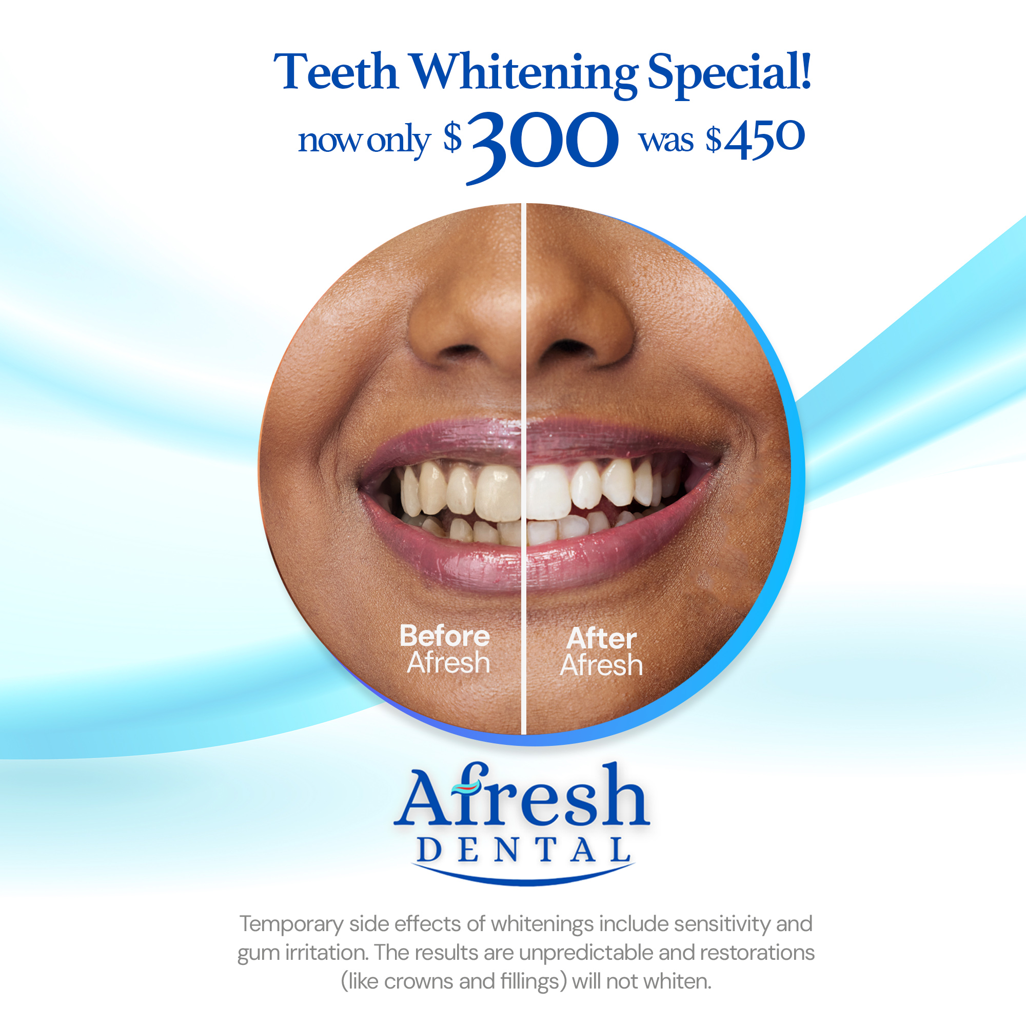 Afresh Dental Facebook ad