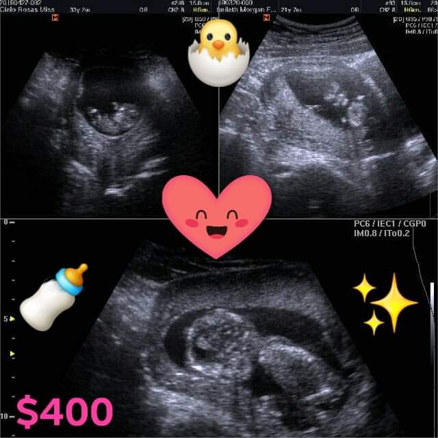 Centro De Diagnostico Avanzado Facebook ad: ♡ULTRASONIDOS♡