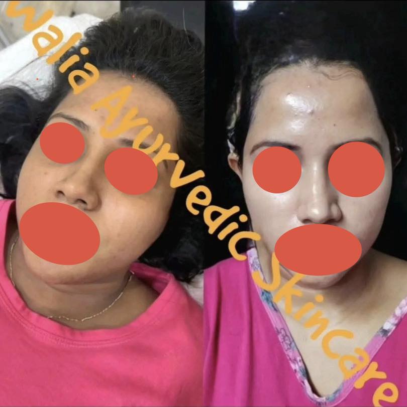 Waliaz Ayurvedic Skincare Facebook ad: SAT SRI AKAL JI