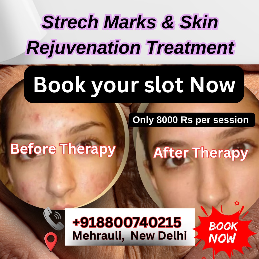 Best PCOS Specialist doctor in India Facebook ad: Sure Here is your Instagram post with clean…
