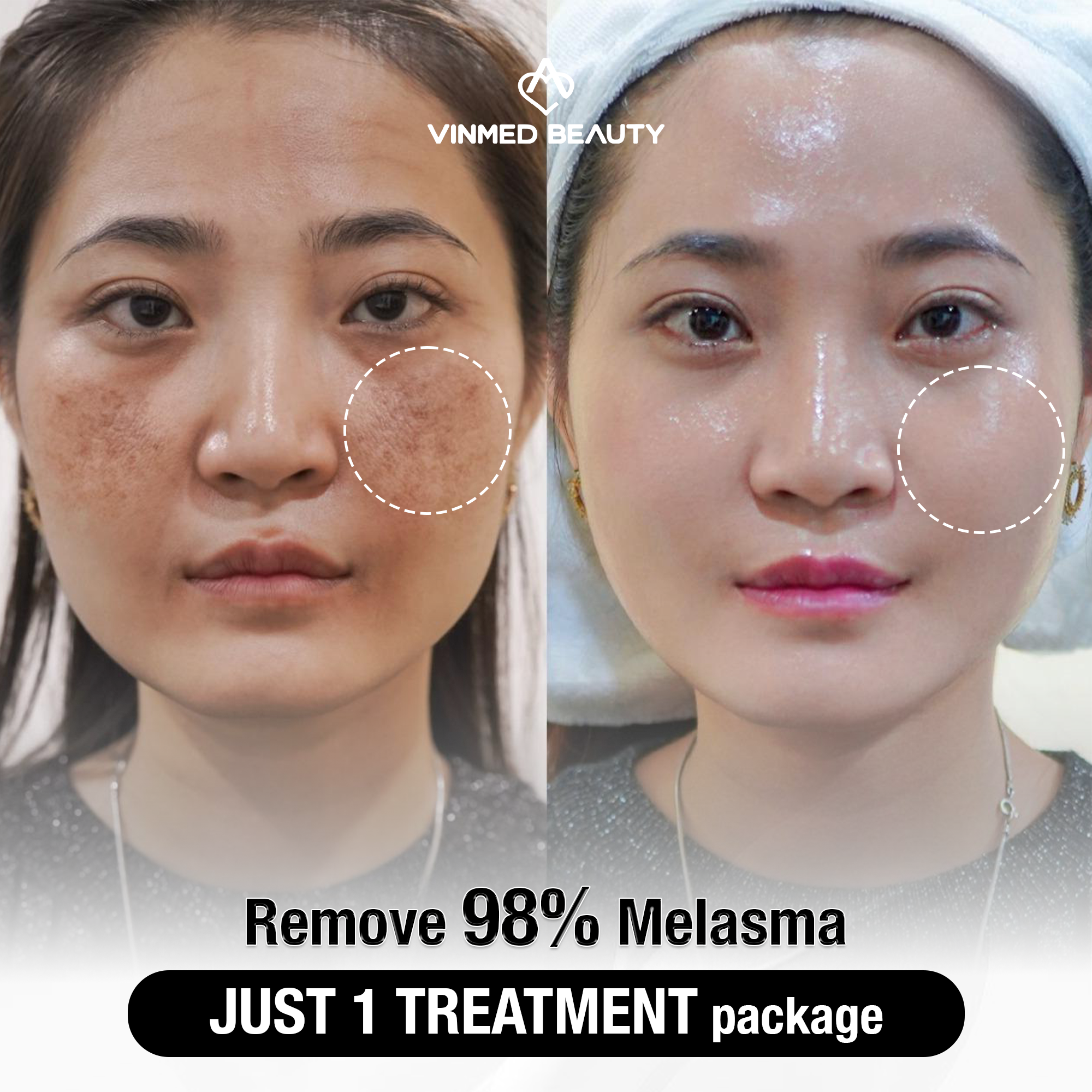 Vinmed Beauty - Luxury Aesthetic Center in Dubai Facebook ad