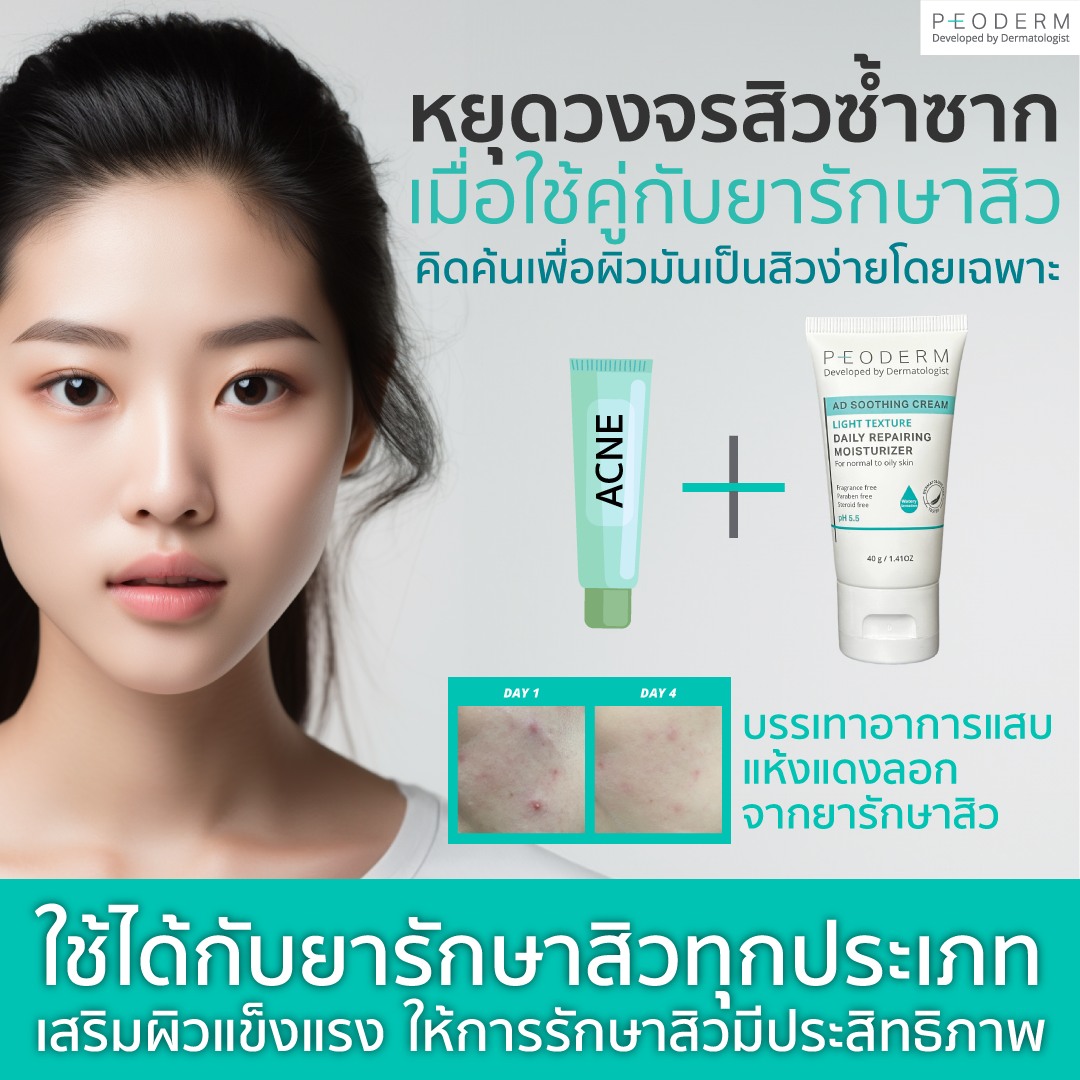 Peoderm Facebook ad: การรักษาสิวที่ดีที่สุดคือการทายารักษาสิว…