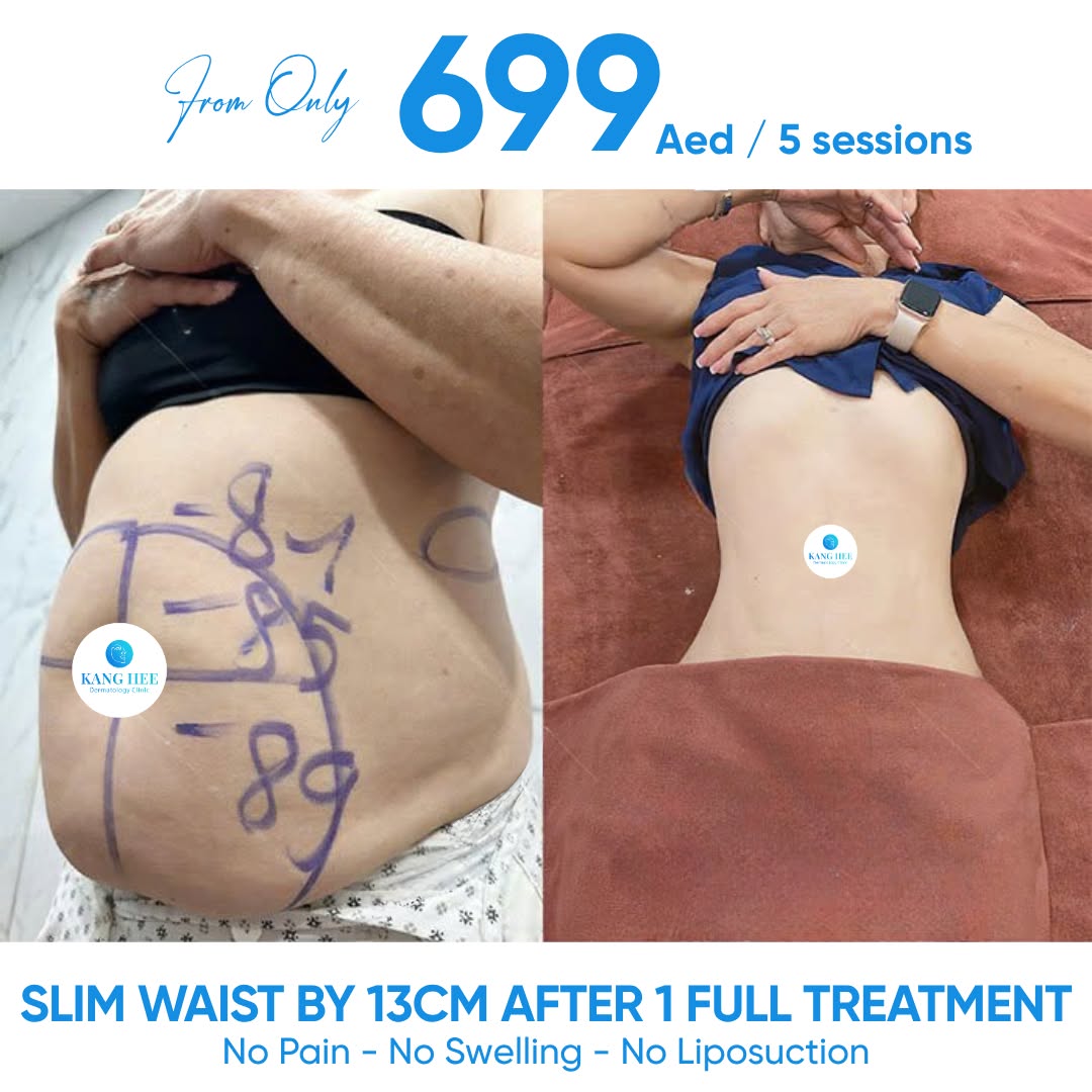 KangHee International Aesthetic Institute Facebook ad: LOSE 10KG-13cm SLIM WAIST