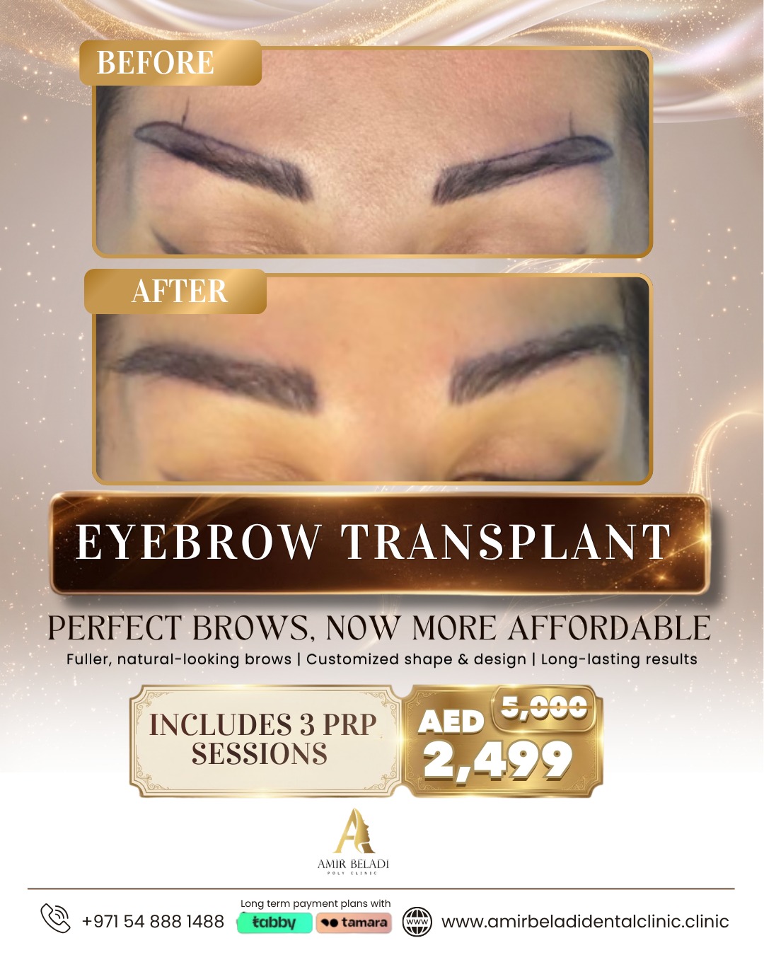 Amir Beladi Polyclinic Facebook ad: That after is not makeup.