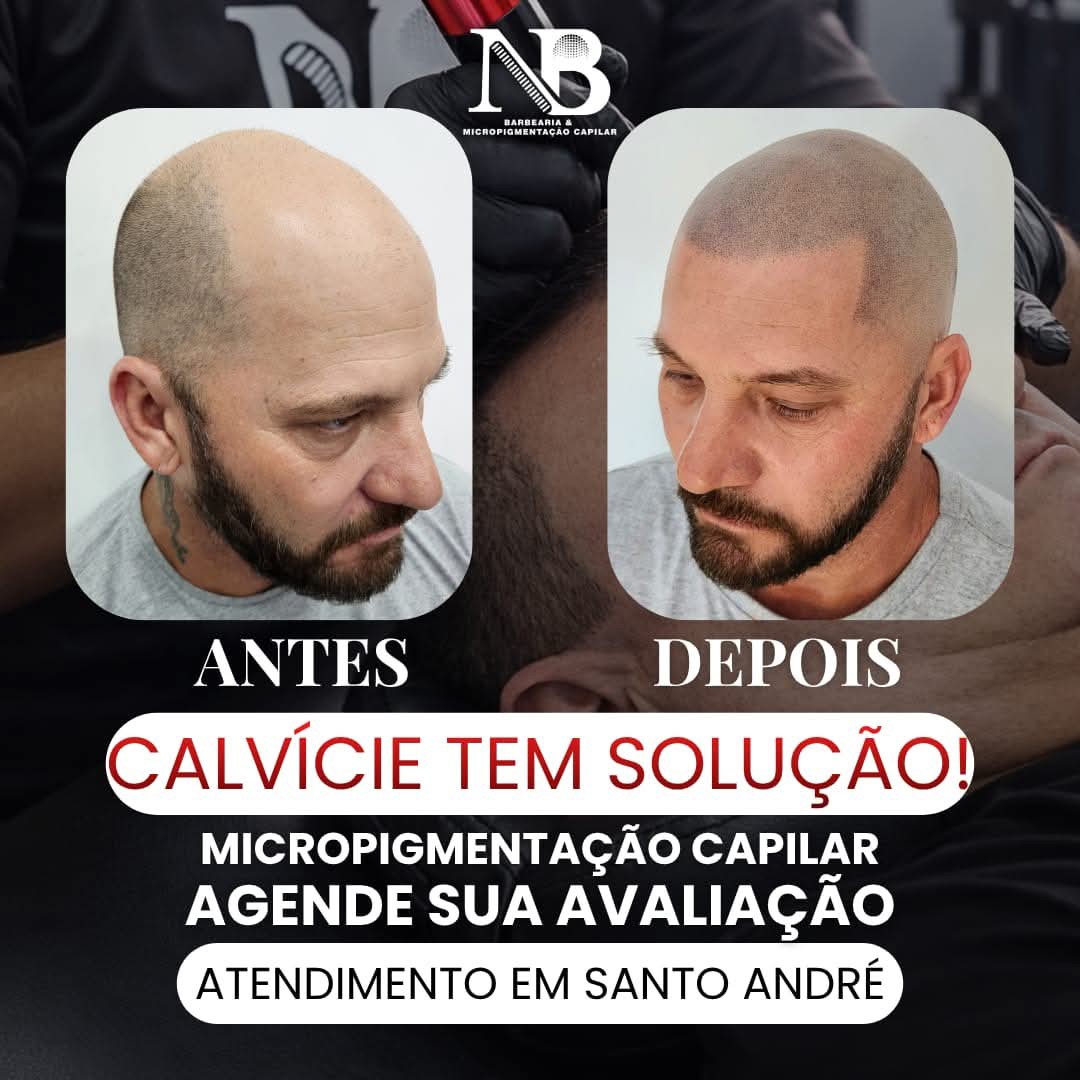 Espaço NB - Micropigmentação Capilar & Barbearia Facebook ad from Apr 10, 2026