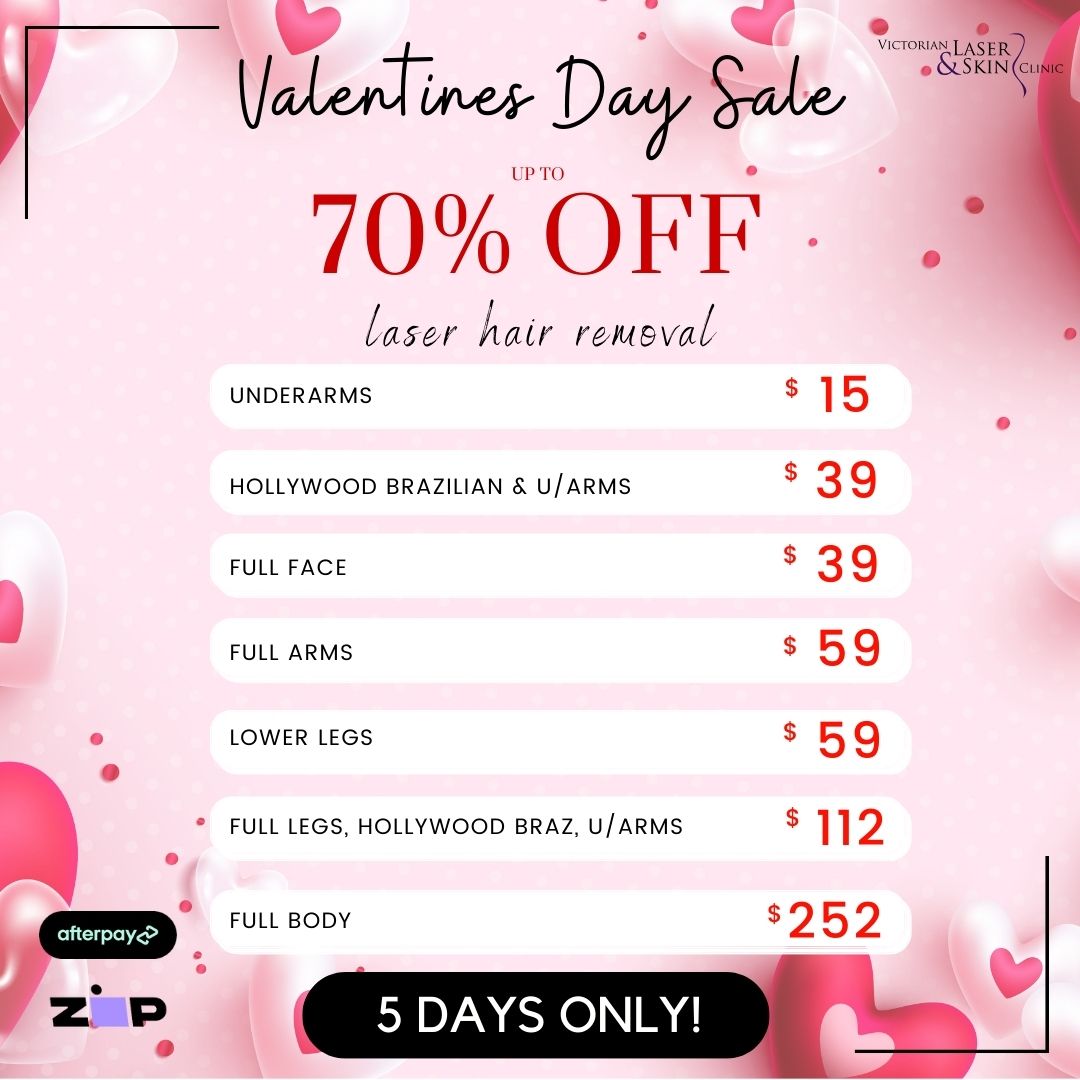 Victorian Laser & Skin Clinic Facebook ad: Valentine's Day Super Sale | Up to 70% Off | 5 Days Only |…