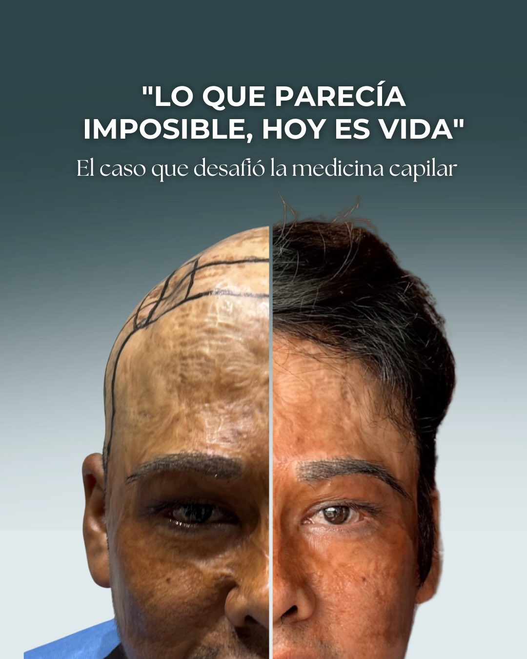 Dr. Esaud - Trasplante Capilar & Medicina Estética Facebook ad