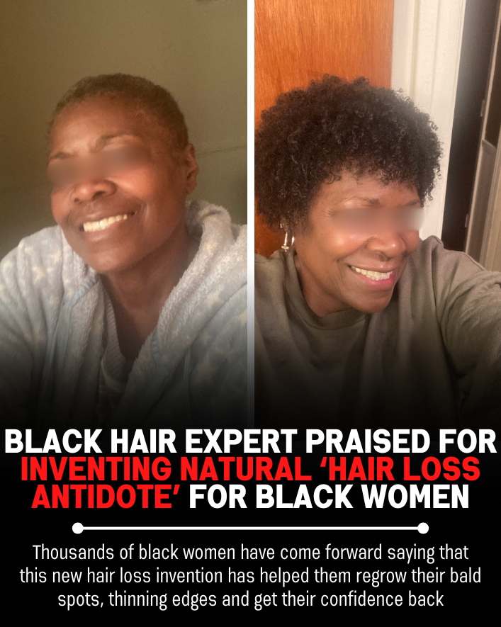Black Hair Growth Remedy Facebook ad