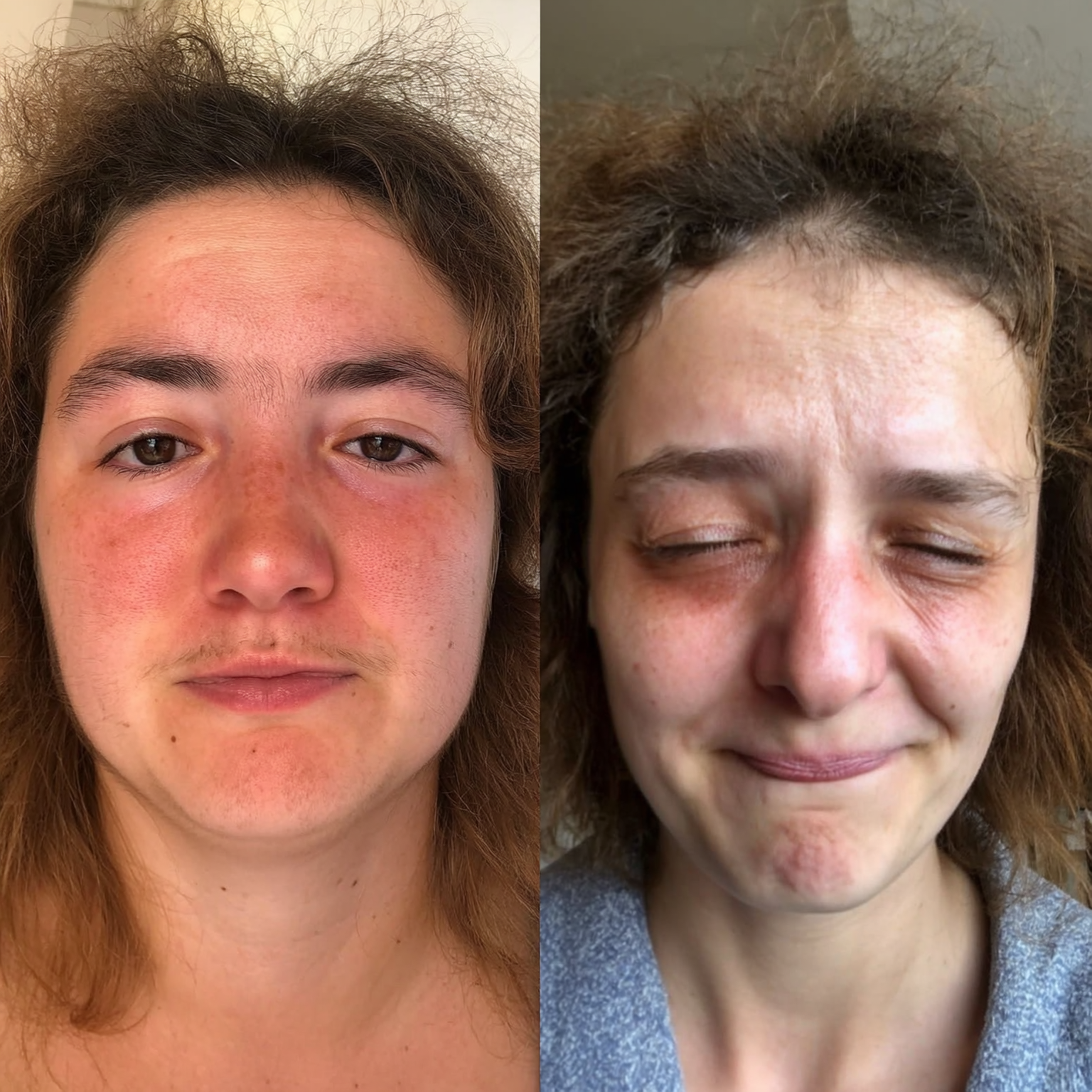 Caroline Reynolds Facebook ad: I reversed Ozempic face naturally