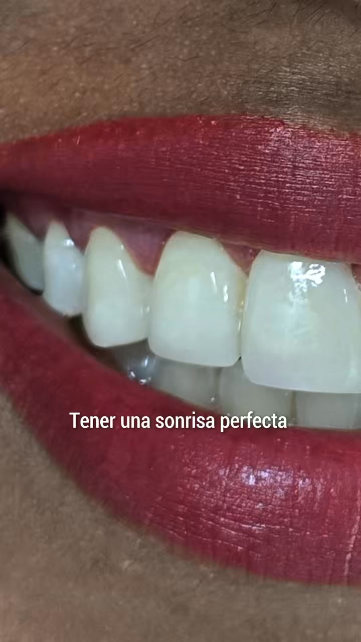 Clínica Previred Popayán Facebook ad: Agendar Valoración SIN COSTO