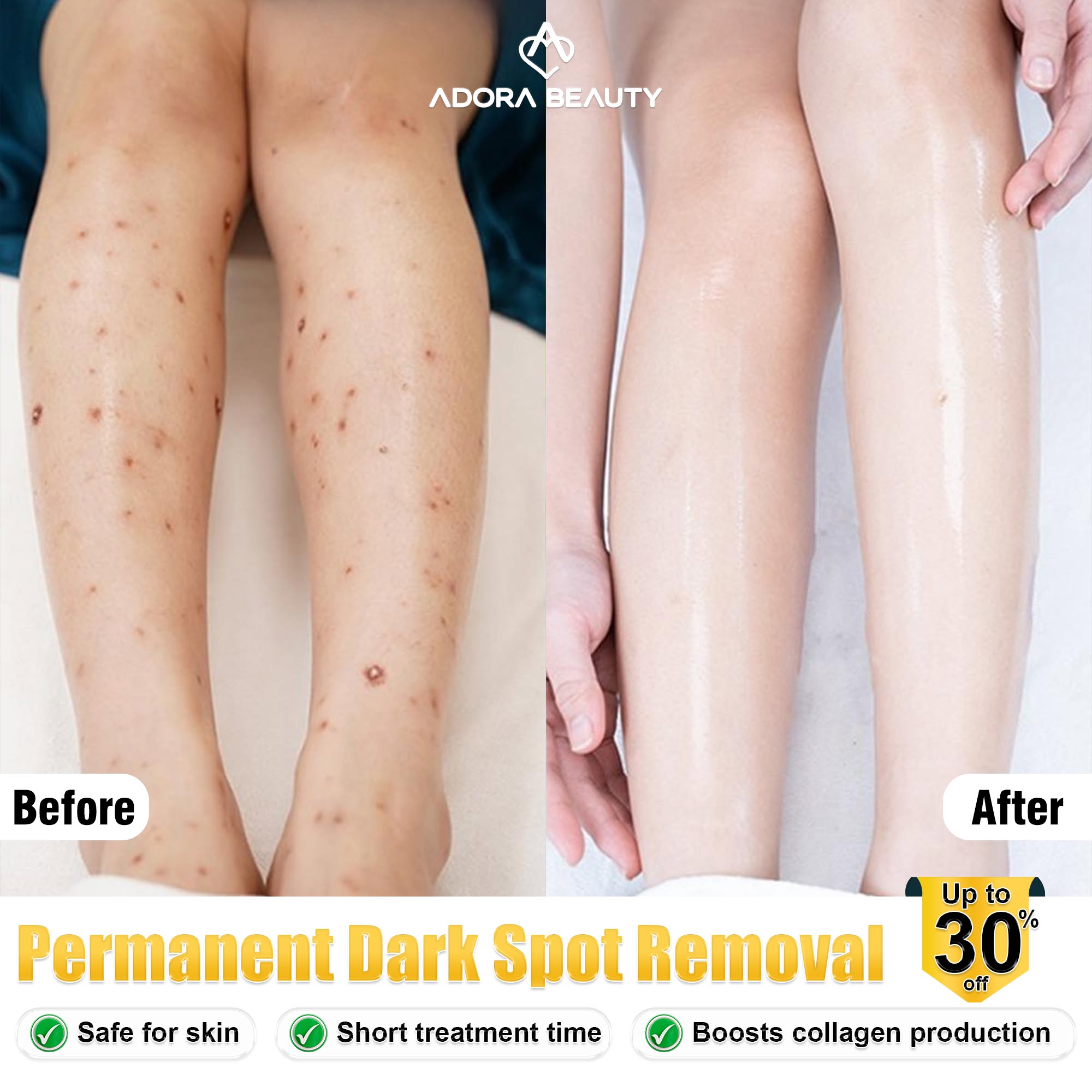 High-Tech Adora Skin Clinic in Manila Facebook ad: Discount 30% First 10 Customers Only