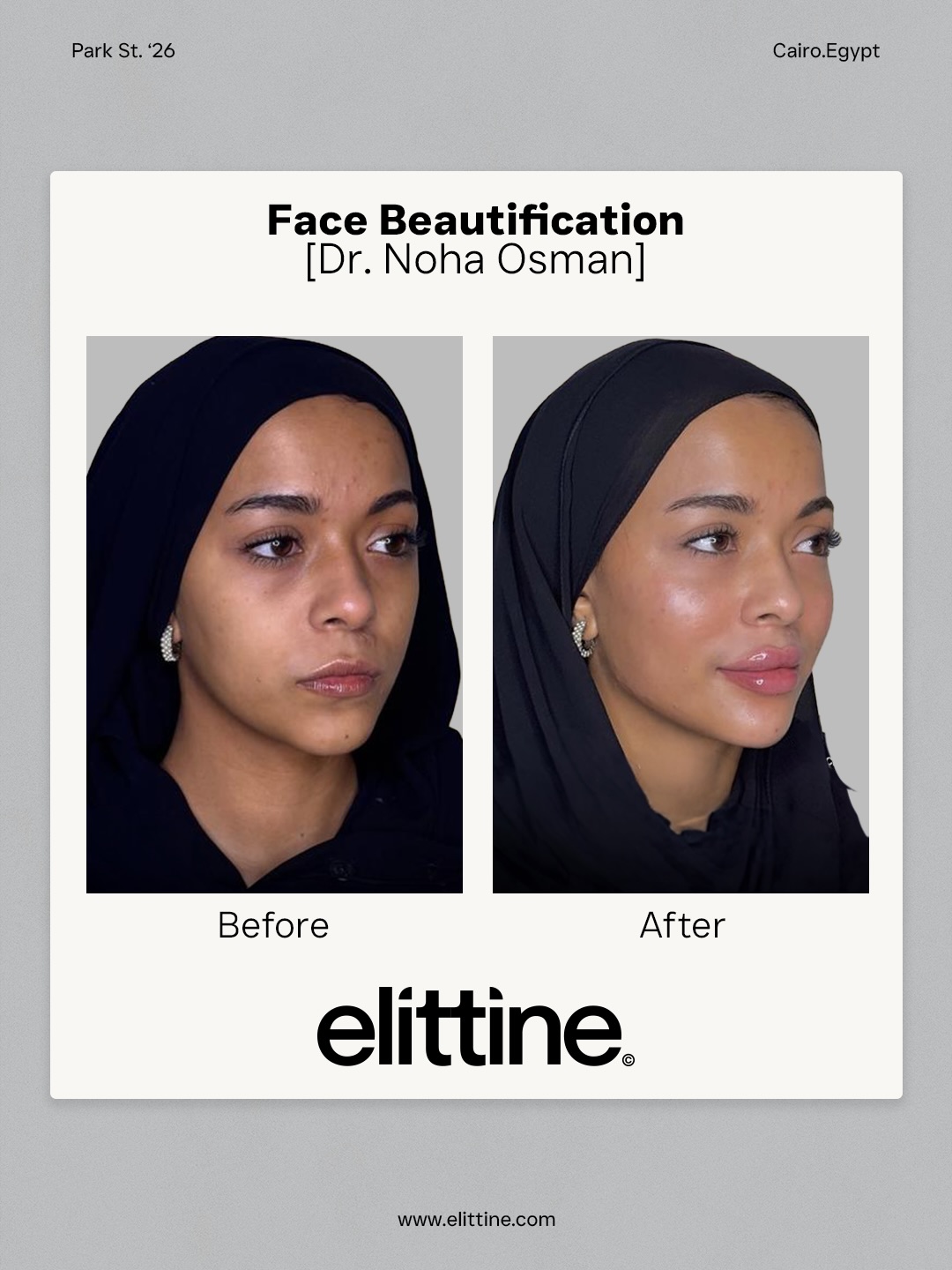Elittine Facebook ad: Every face tells a different story, and every…