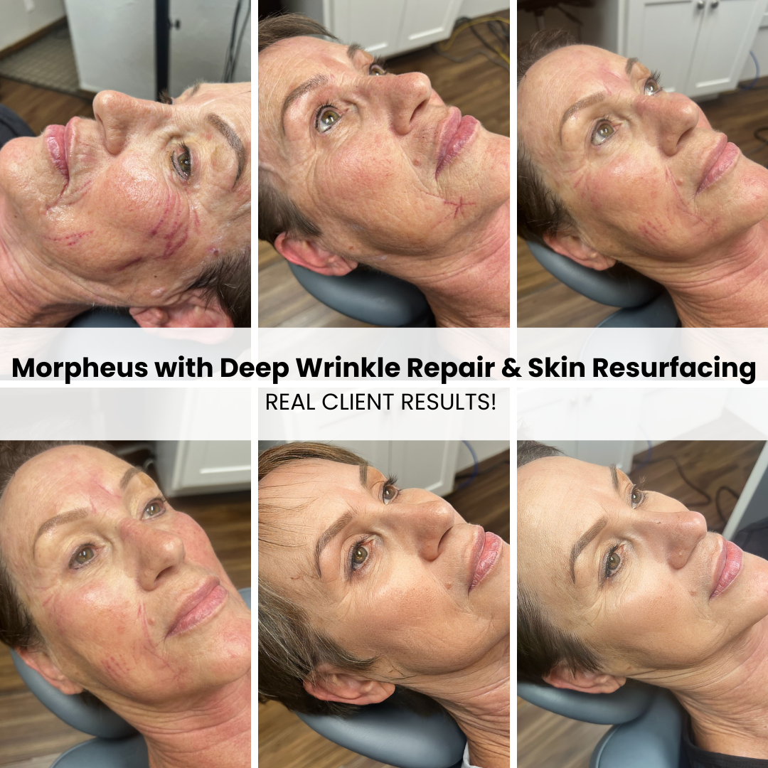 Creative Faces Permanent Makeup and Med Spa Facebook ad: See Results In Just One Session!