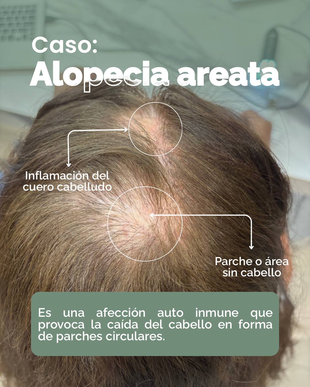 Dra. Eugenia Rozados Facebook ad: Si notas parches definidos o zonas con caída…