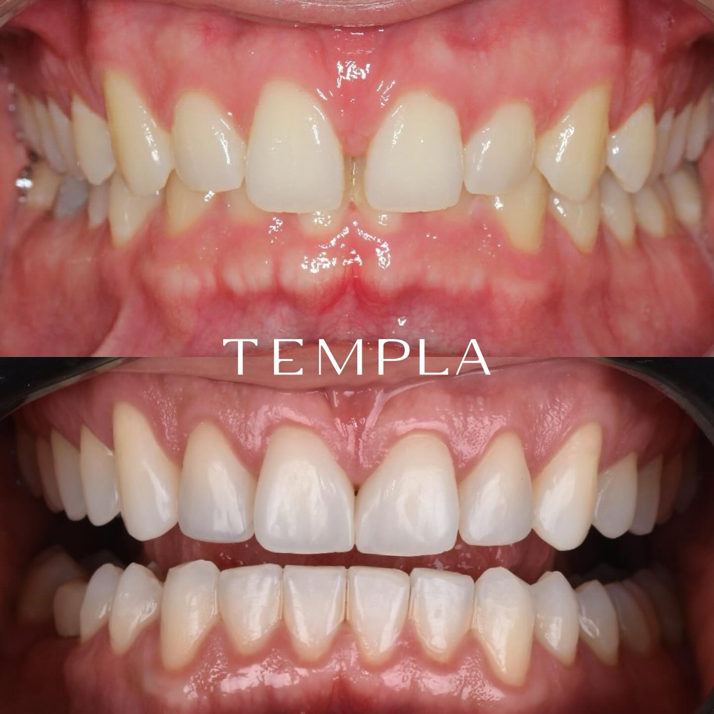 Templa Odontologia Facebook ad: Transformações que falam por si!