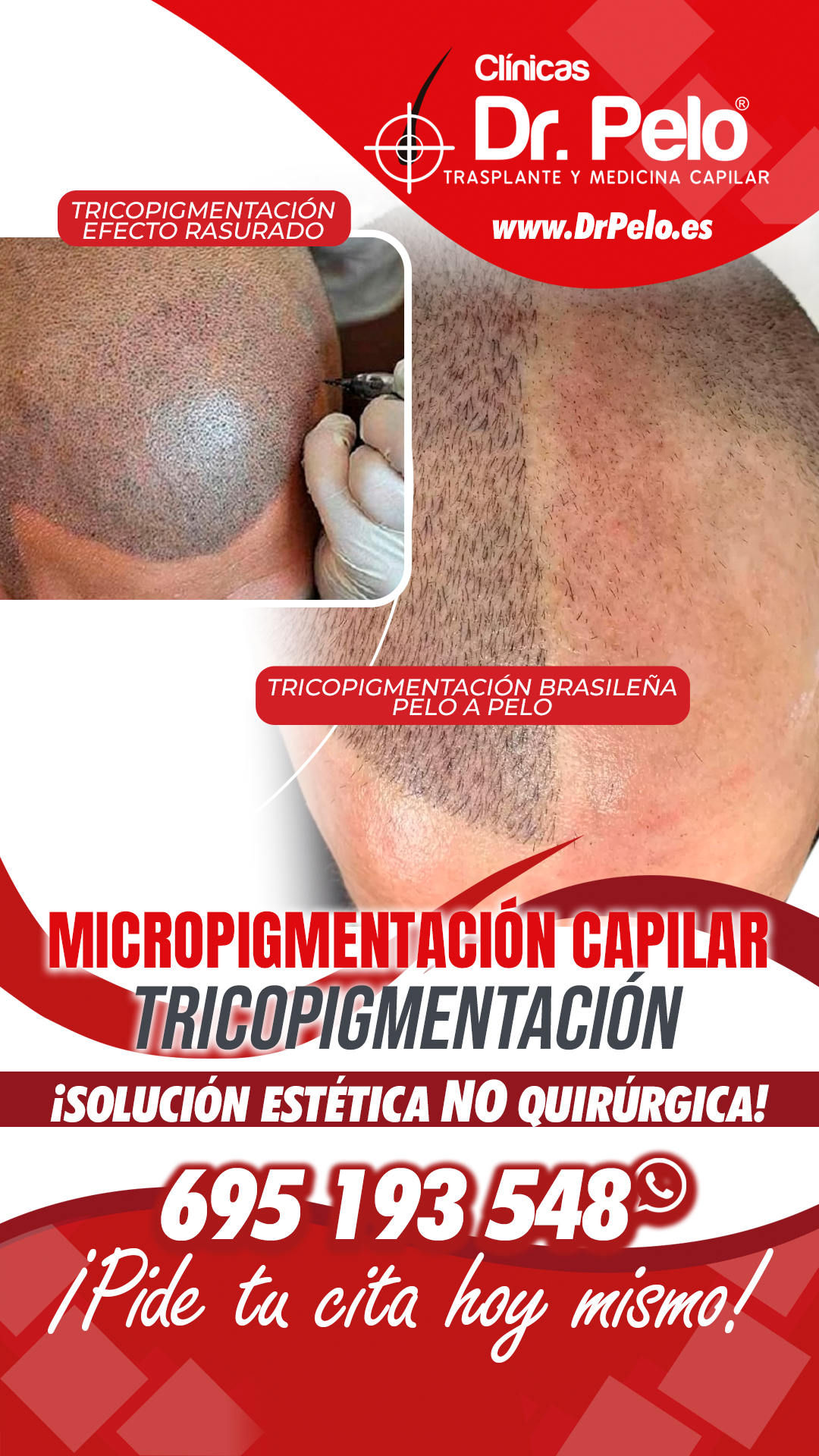 Clinicas Dr Pelo Facebook ad