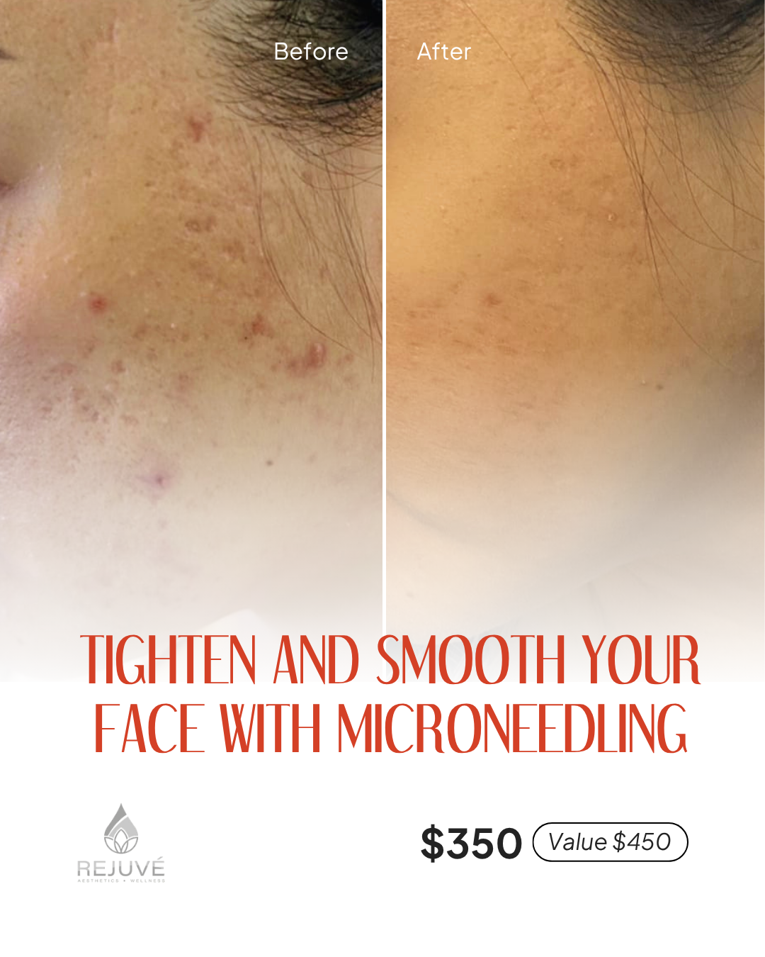 Rejuvé Aesthetics & Wellness Facebook ad: Tighten and Smooth Your Face
